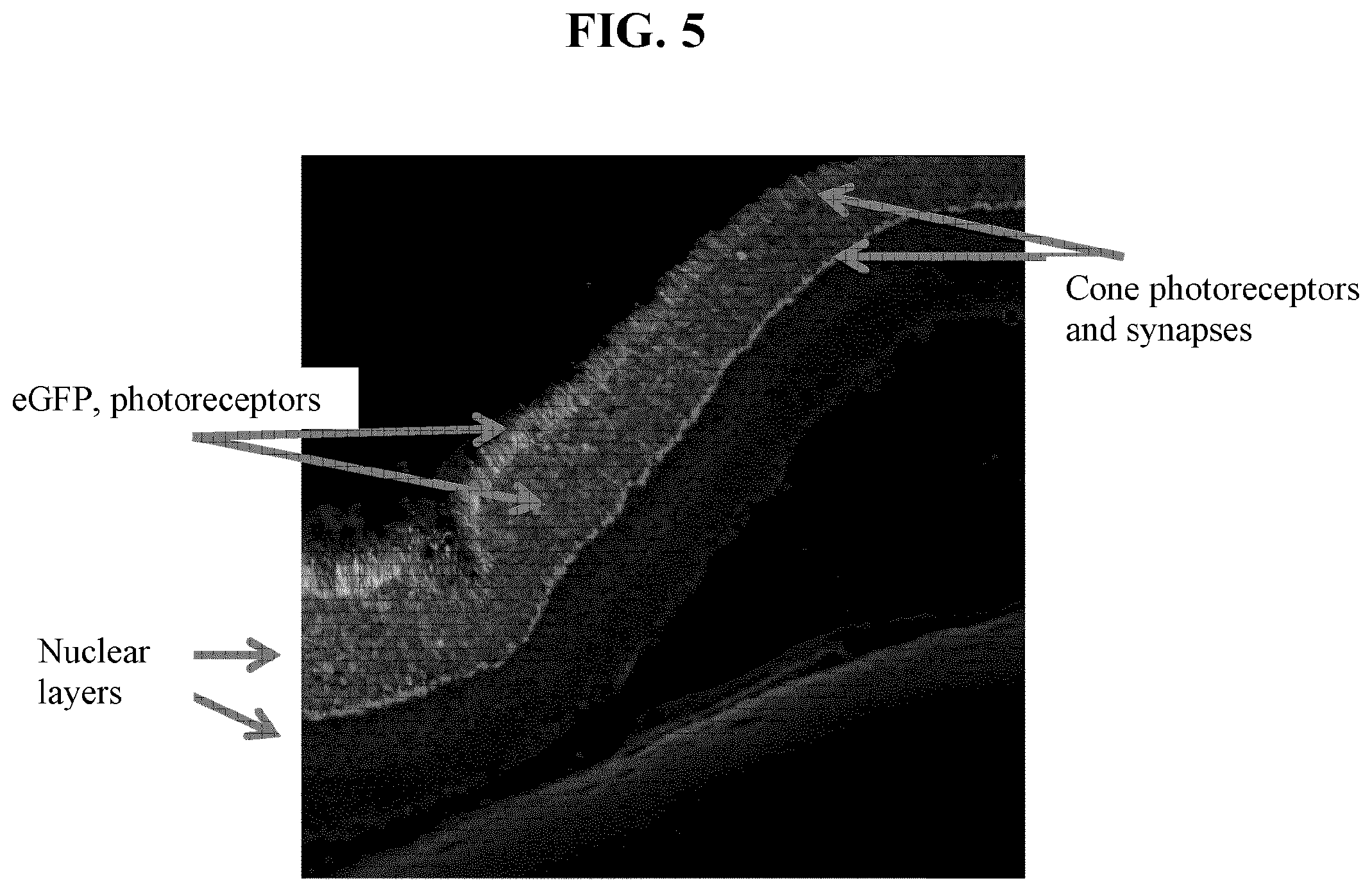 Patent US11793887 Figure 9 – Gene therapy for treating peroxisomal disorders