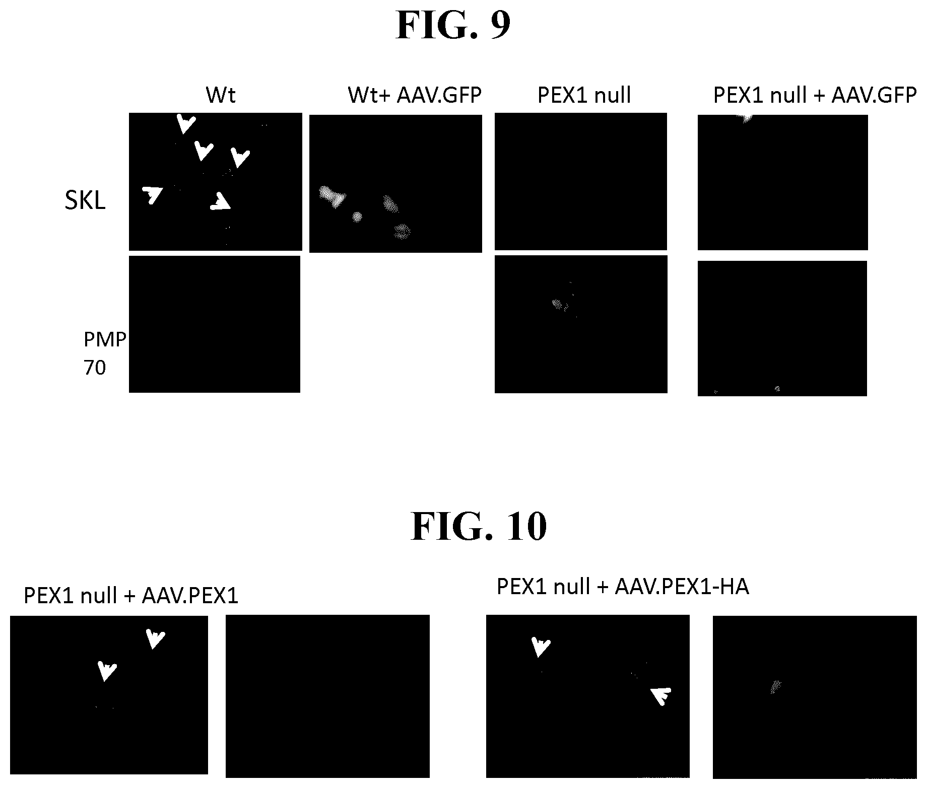Patent US11793887 Figure 12 – Gene therapy for treating peroxisomal disorders