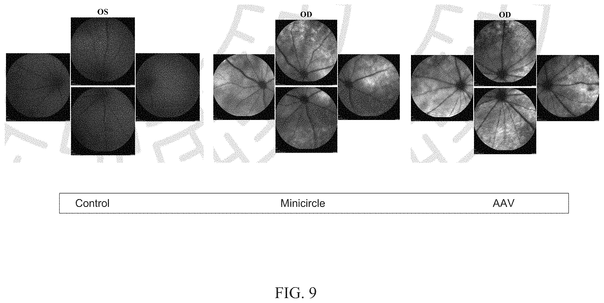 Patent US11793890 Figure 9 – ELOVL2 constructs for human gene therapy