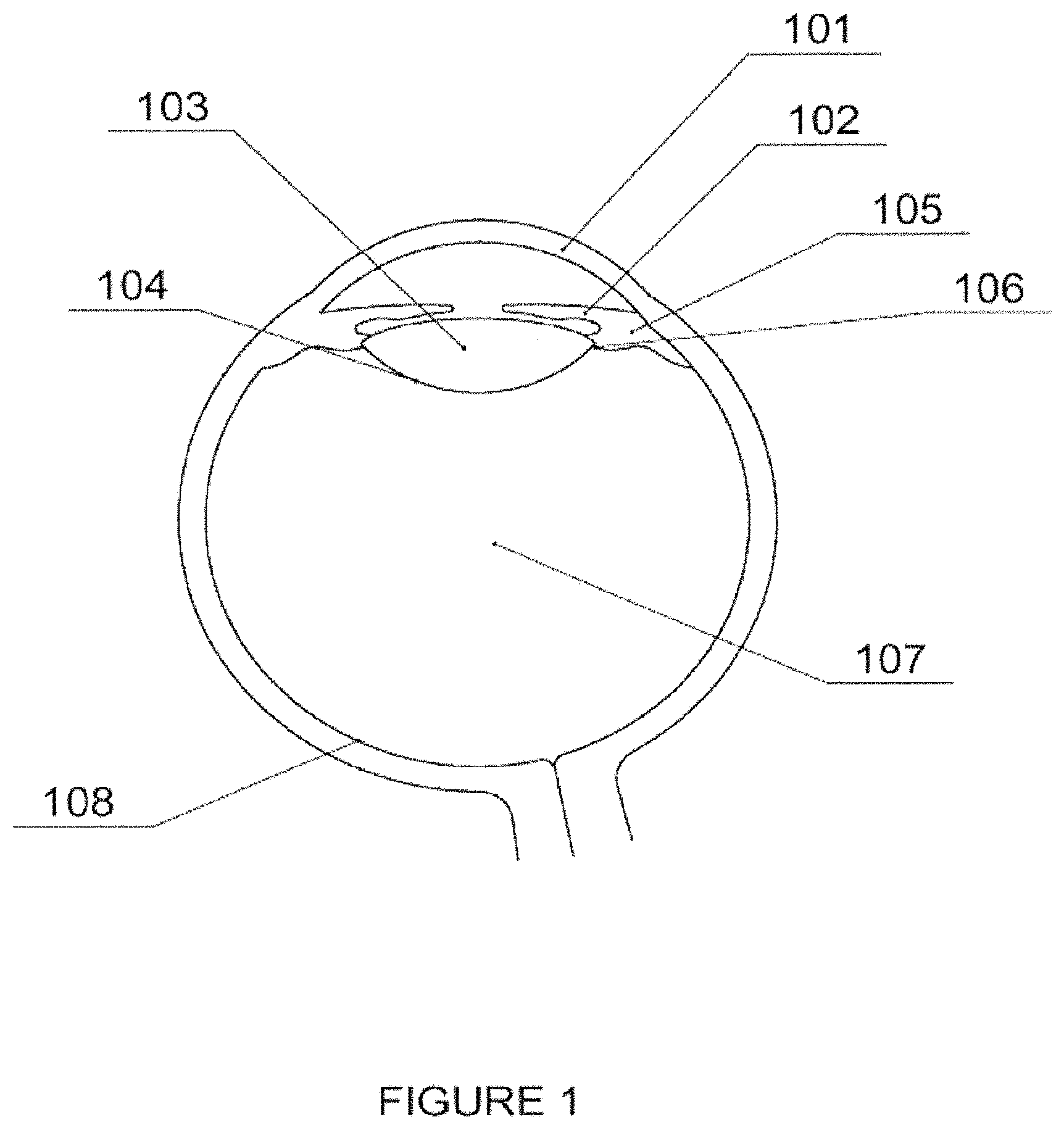 Patent US11793908 Figure 1 – Light-adjustable hydrogel and bioanalogic intraocular lens