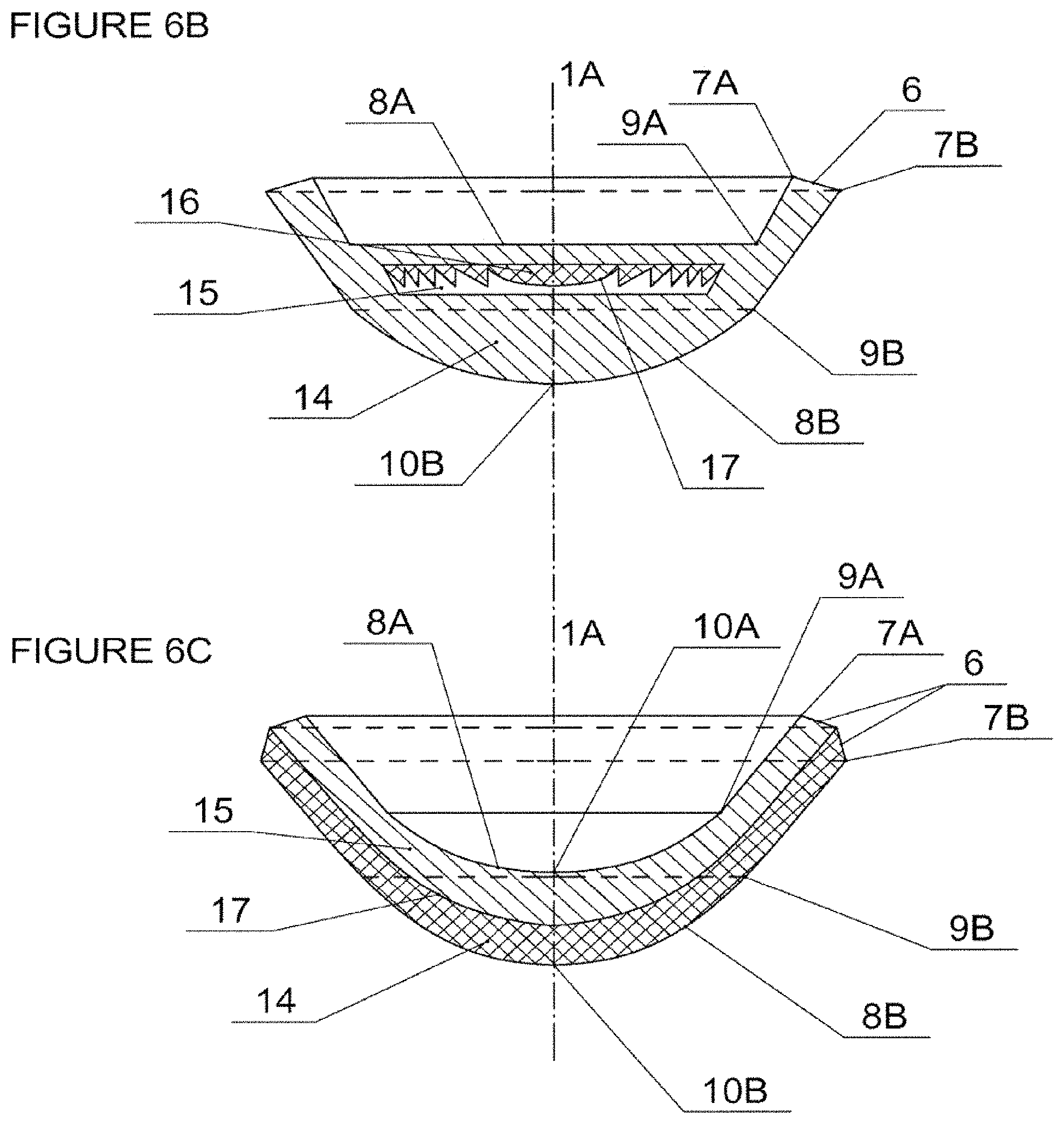 Patent US11793908 Figure 10 – Light-adjustable hydrogel and bioanalogic intraocular lens