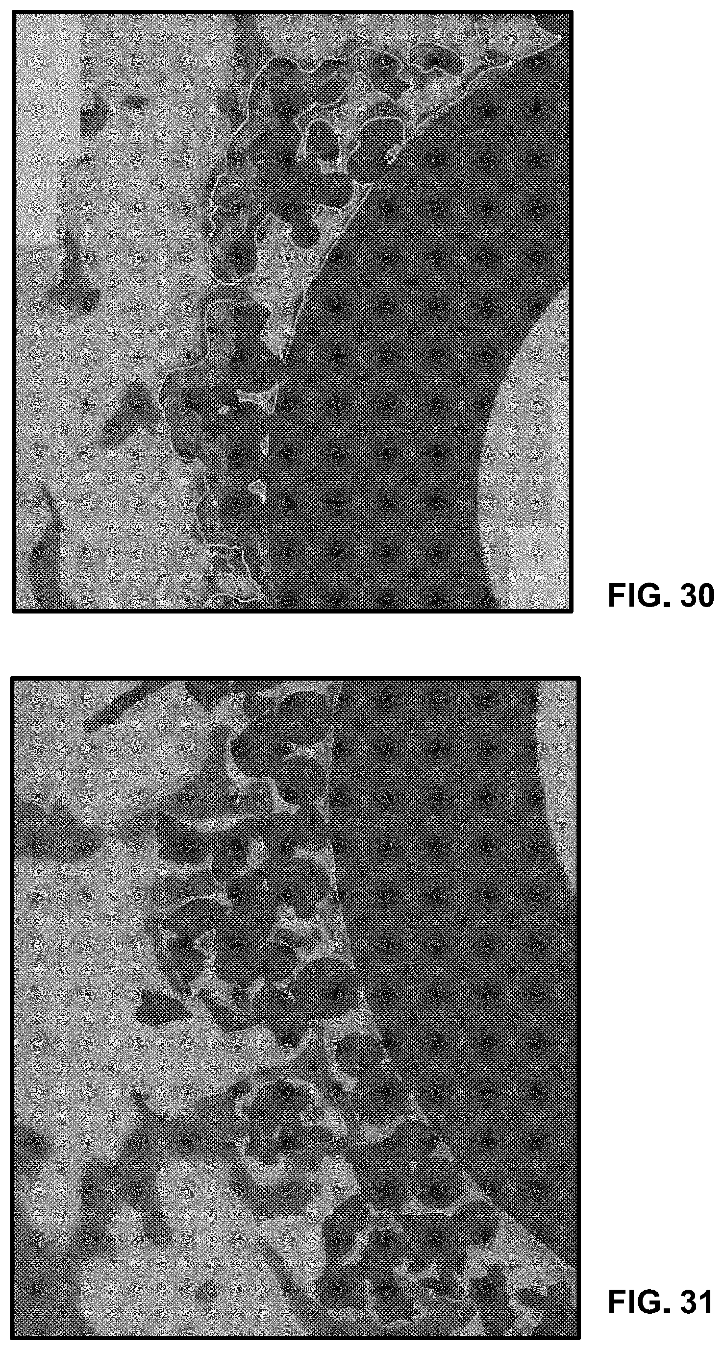 Patent US11793910 Figure 18 – Orthopedic implant having a crystalline calcium phosphate coating and methods for making the same