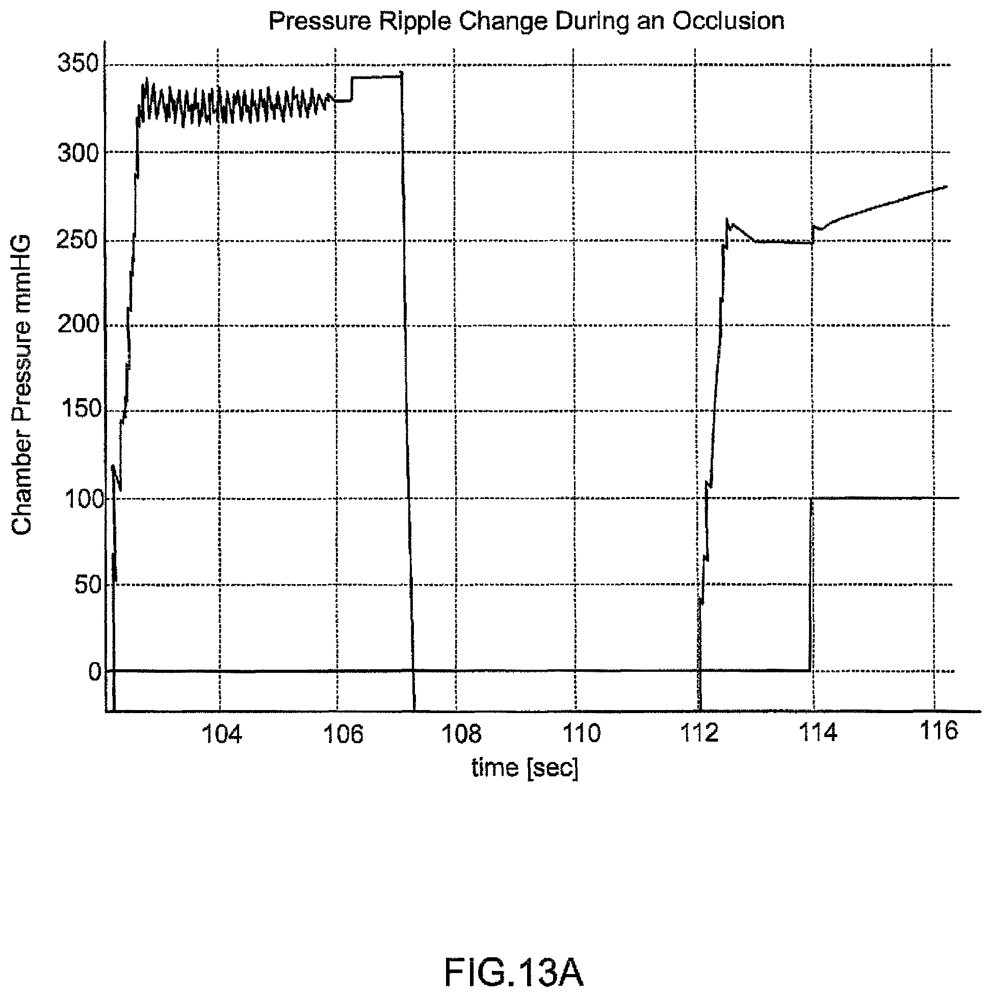 Patent US11793915 Figure 19 – Hemodialysis systems and methods