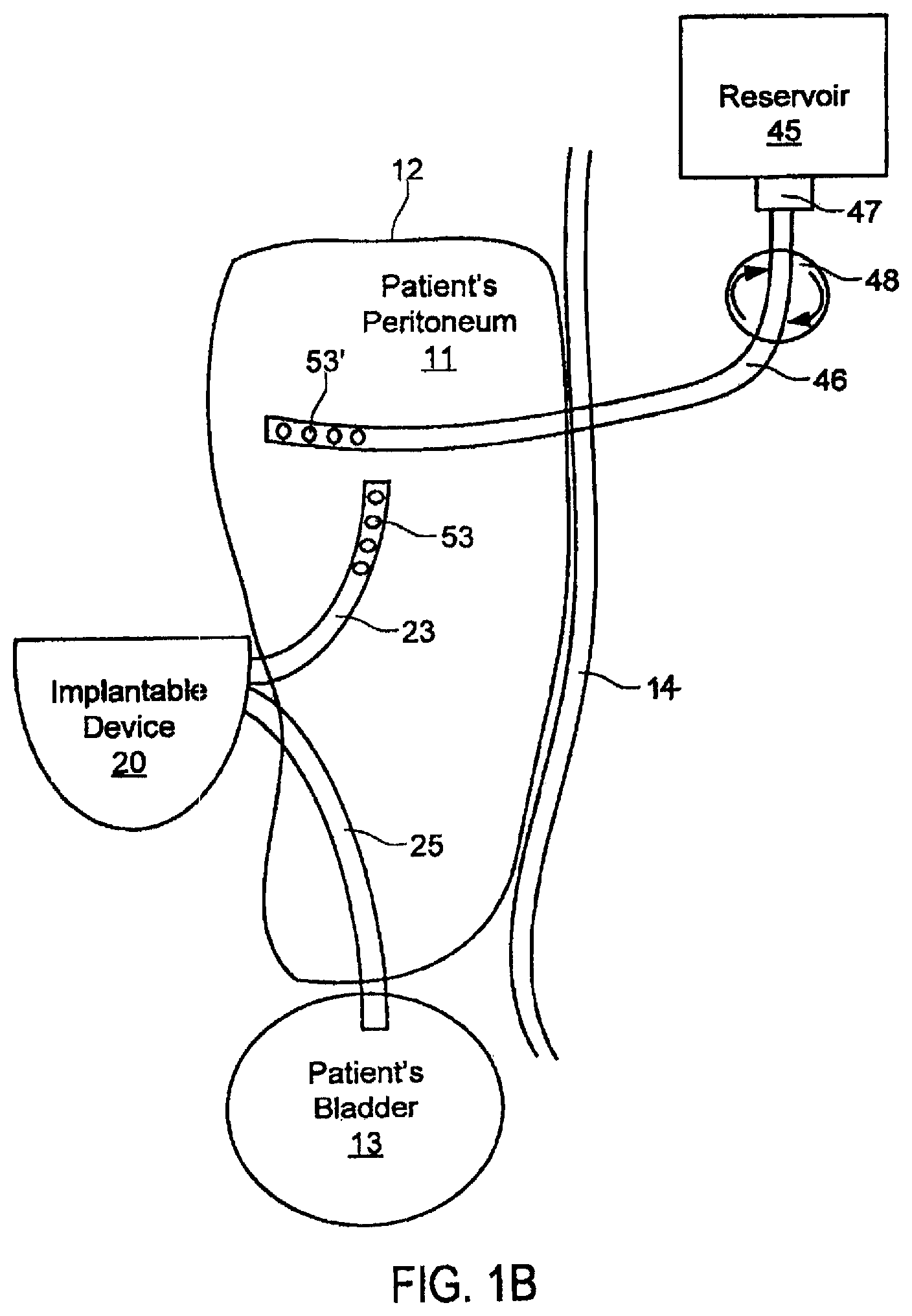 Patent US11793916 Figure 2 – Systems and methods for fluid management
