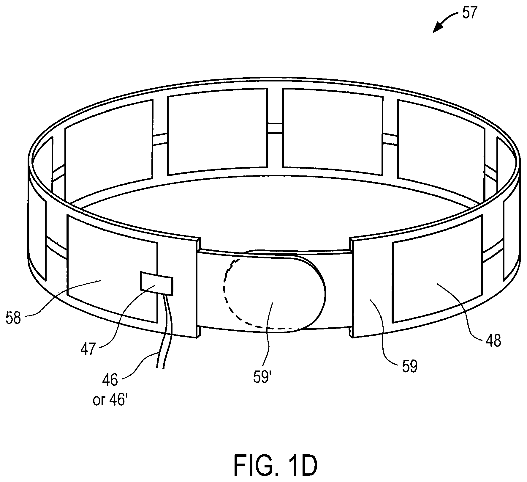 Patent US11793916 Figure 4 – Systems and methods for fluid management