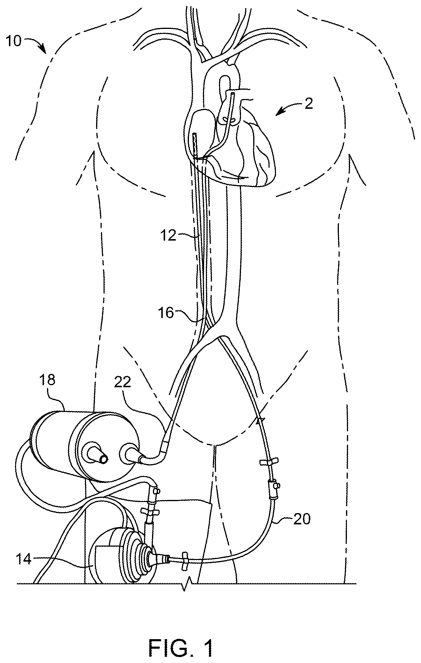 Patent US11793918 Figure 1 – Priming tray for priming a fluid system