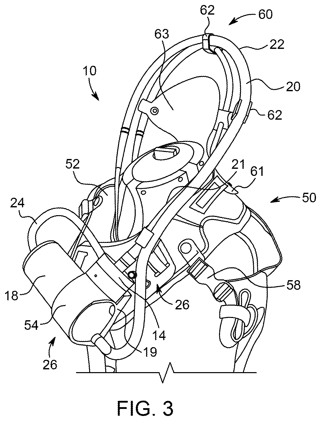 Patent US11793918 Figure 3 – Priming tray for priming a fluid system