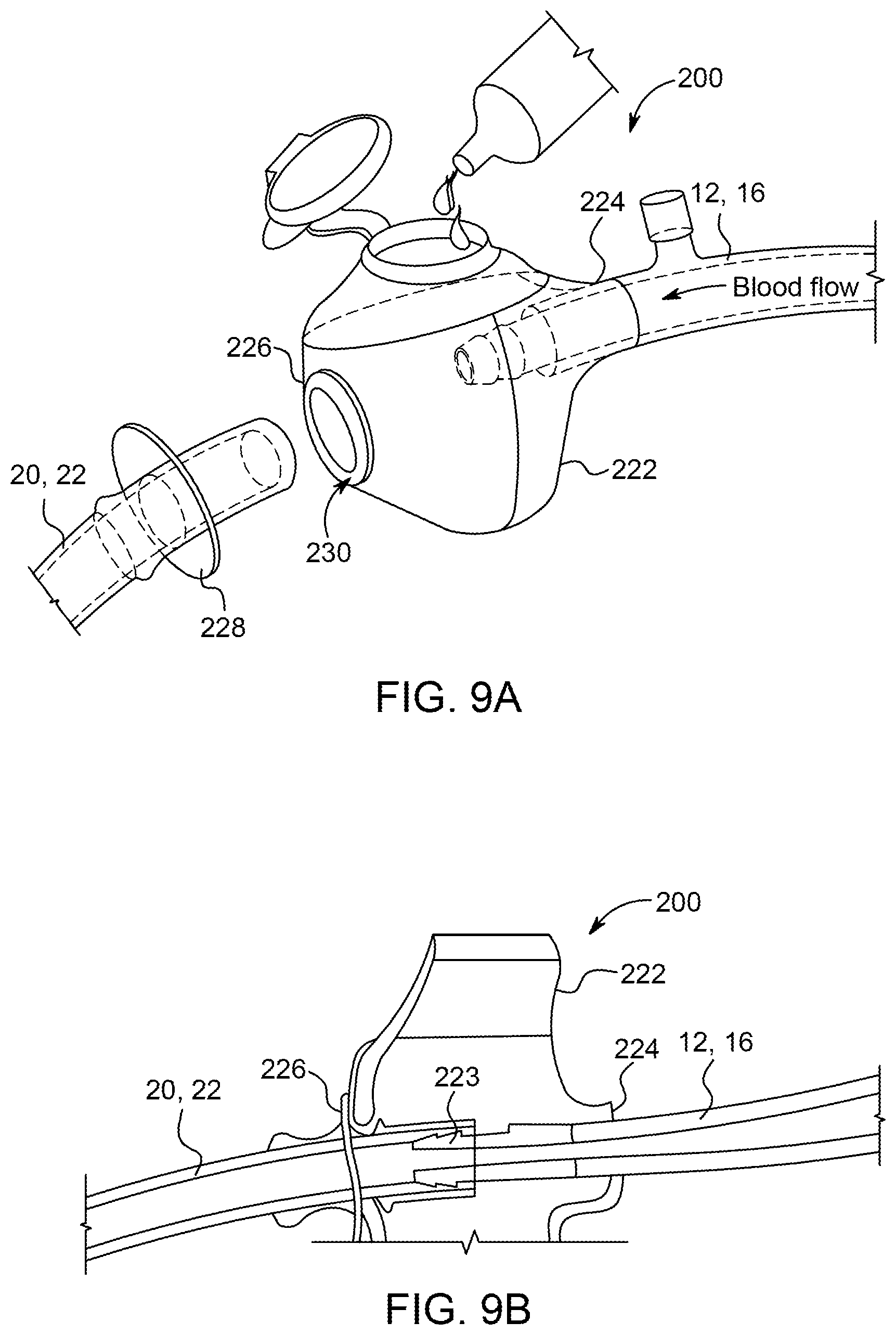Patent US11793918 Figure 10 – Priming tray for priming a fluid system