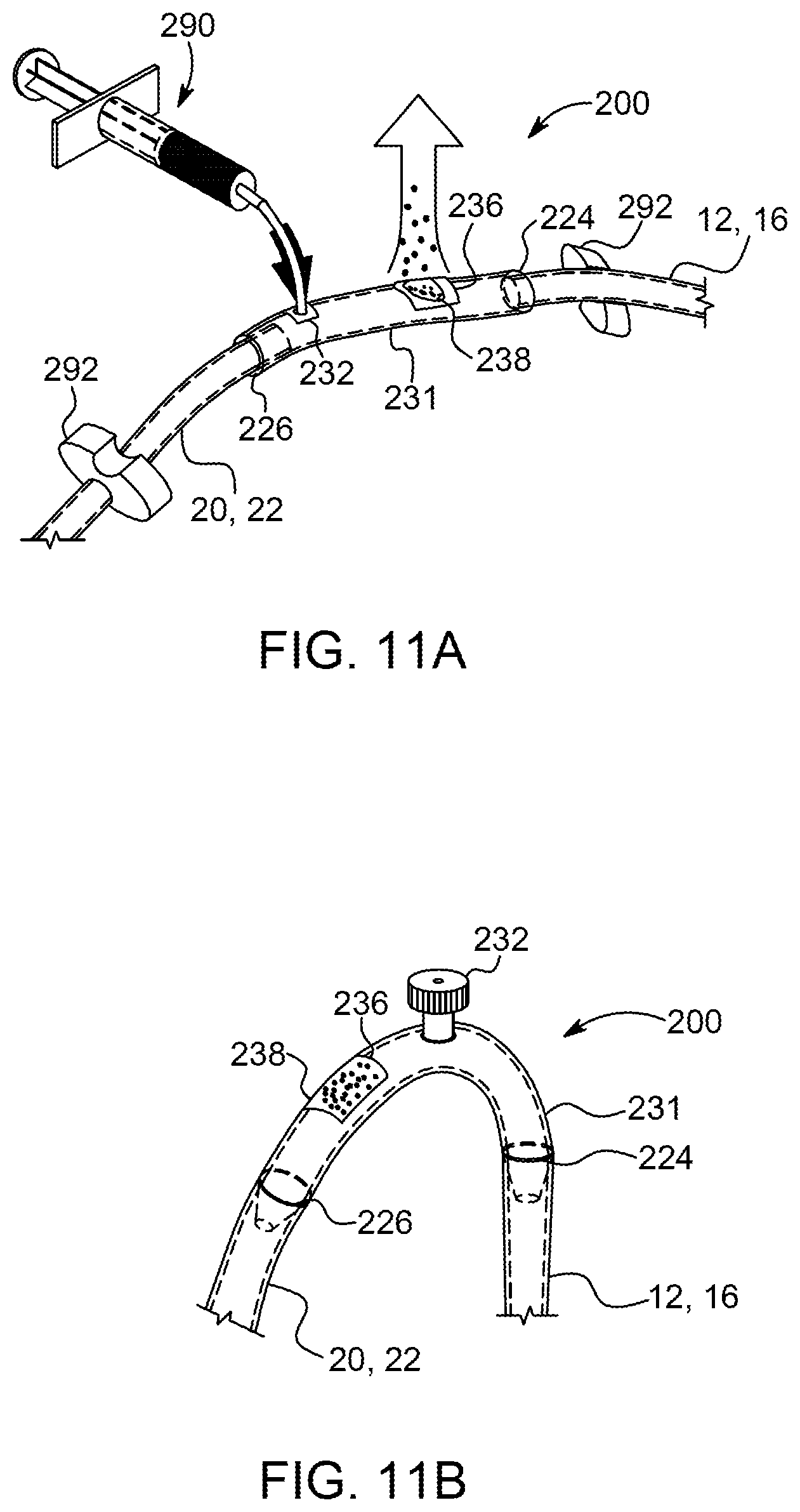 Patent US11793918 Figure 12 – Priming tray for priming a fluid system