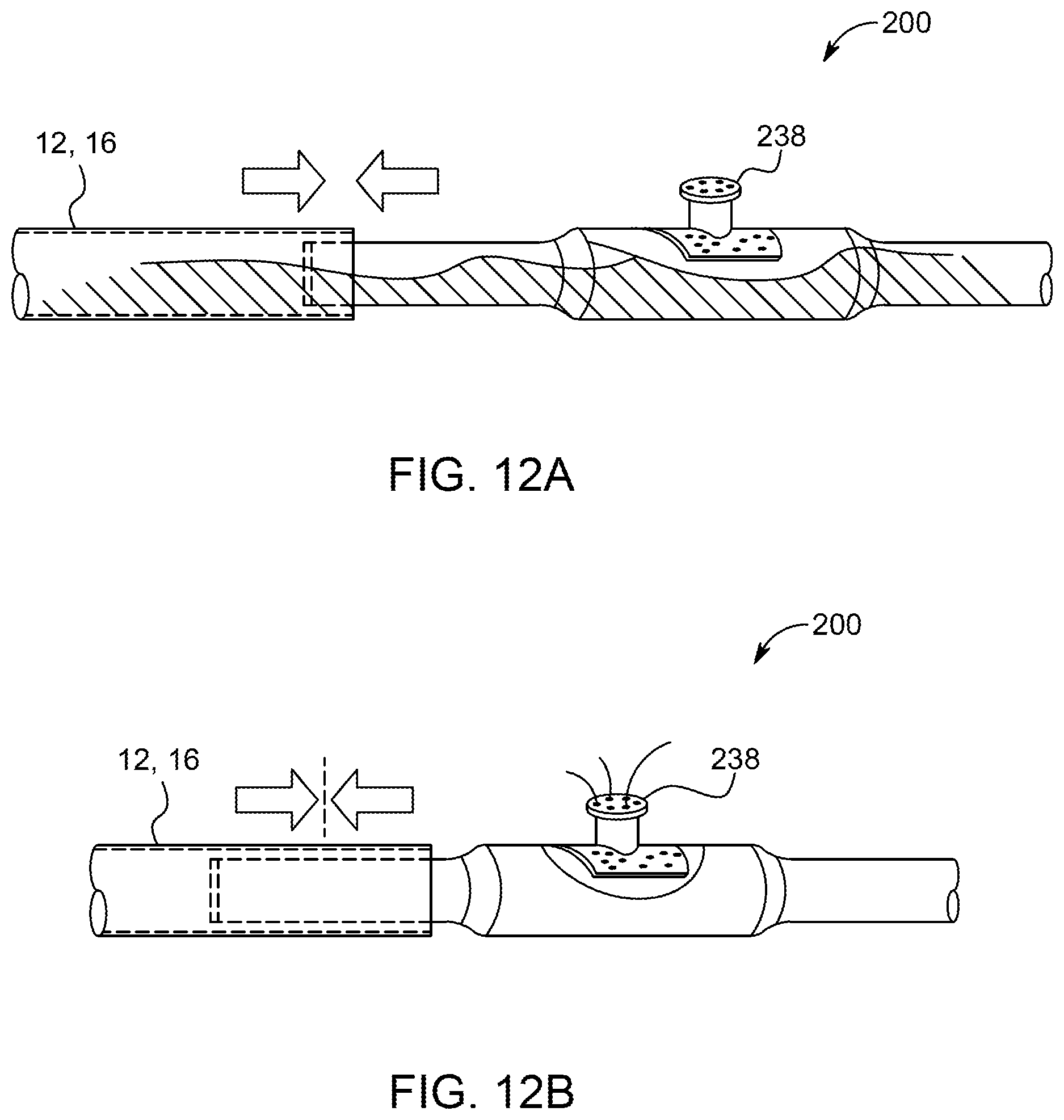 Patent US11793918 Figure 13 – Priming tray for priming a fluid system