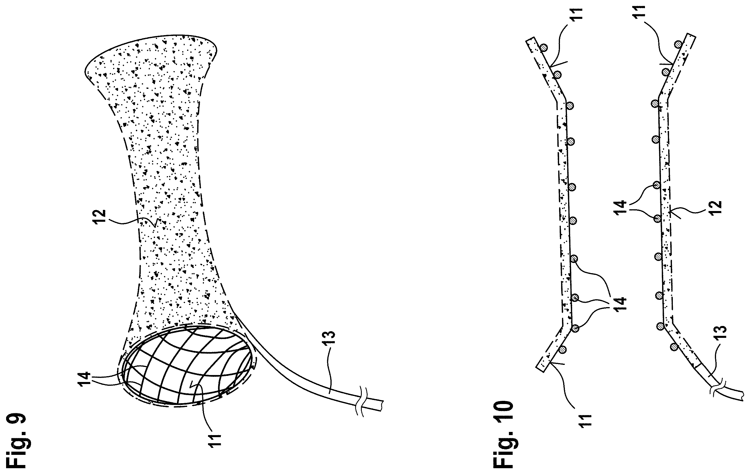 Patent US11793922 Figure 9 – Vacuum treatment array and film for producing a vacuum treatment array