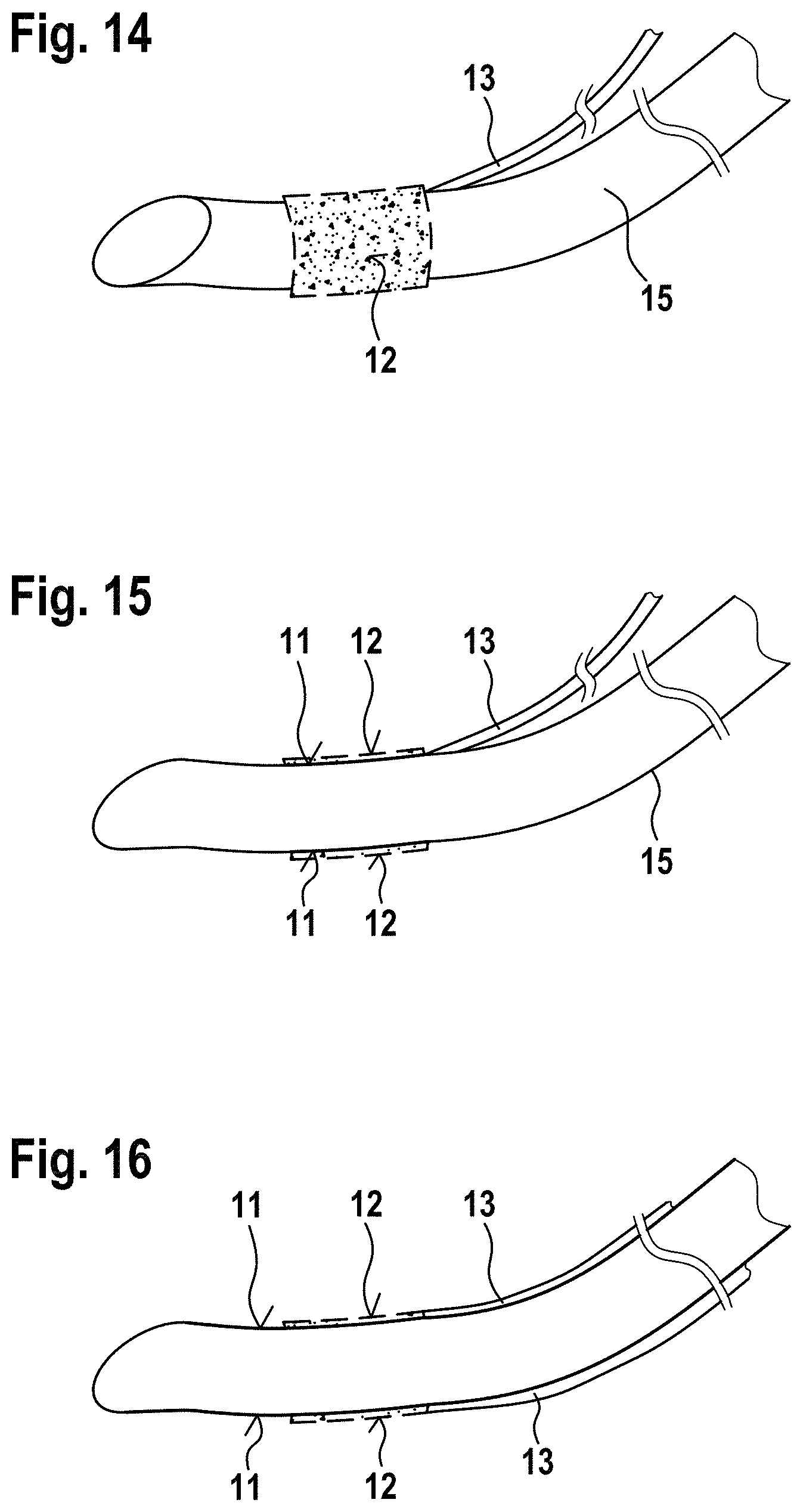 Patent US11793922 Figure 12 – Vacuum treatment array and film for producing a vacuum treatment array