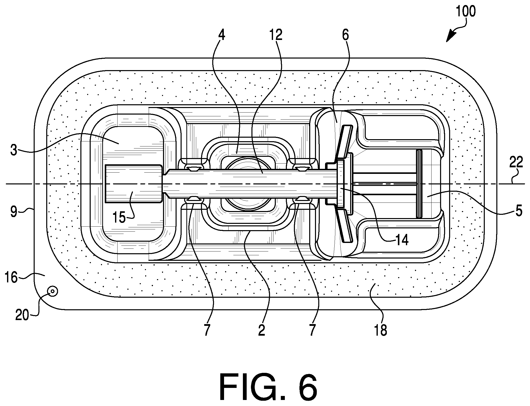 Patent US11793926 Figure 6 – Medical device packaging and related methods