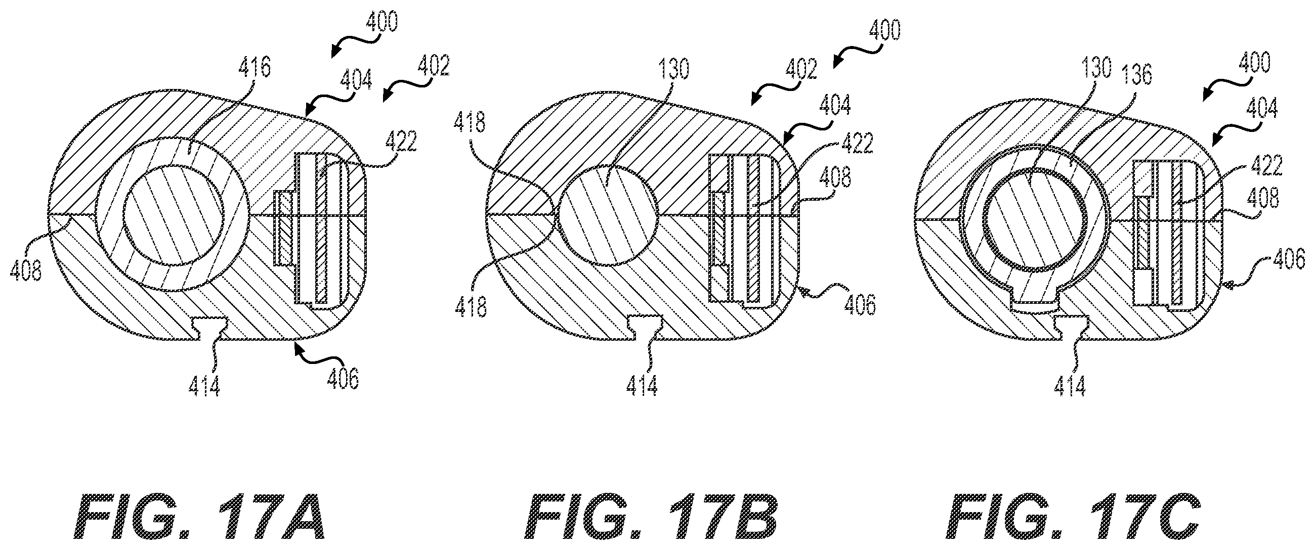 Patent US11793930 Figure 14 – Fluid infusion systems