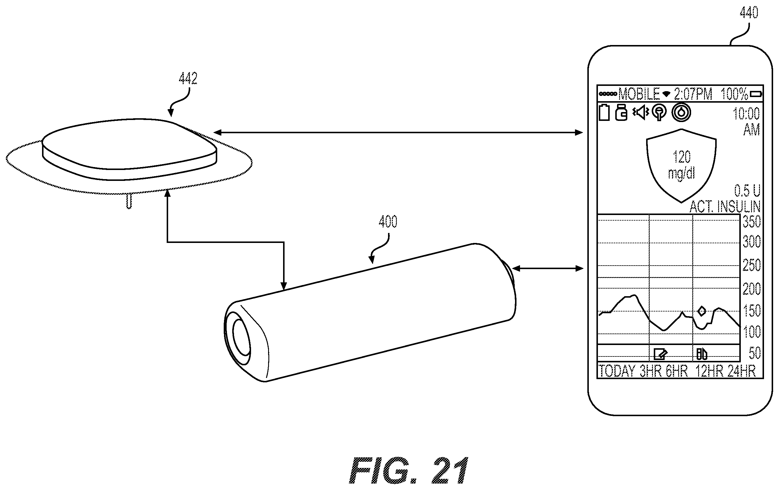 Patent US11793930 Figure 18 – Fluid infusion systems