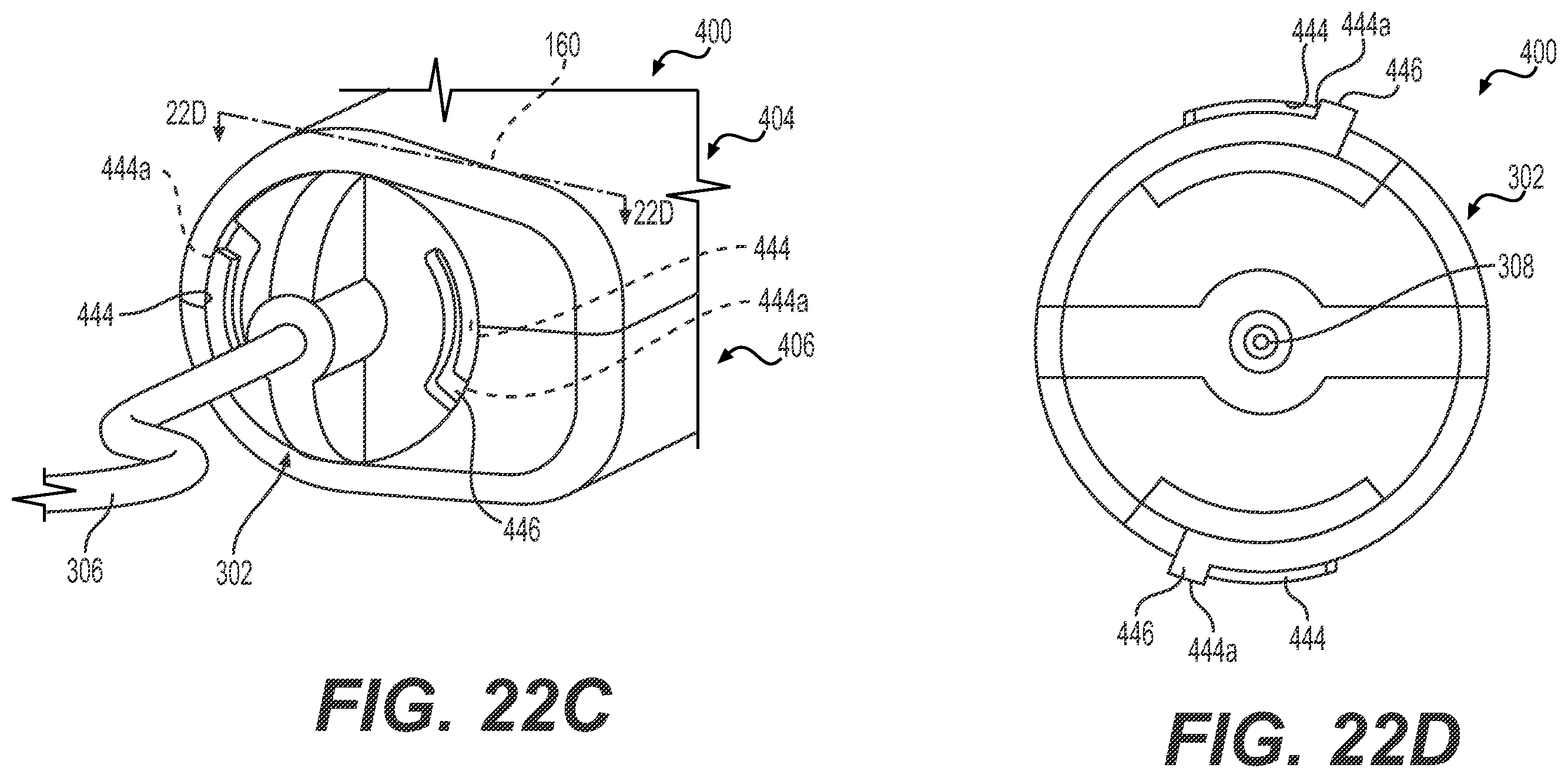 Patent US11793930 Figure 20 – Fluid infusion systems