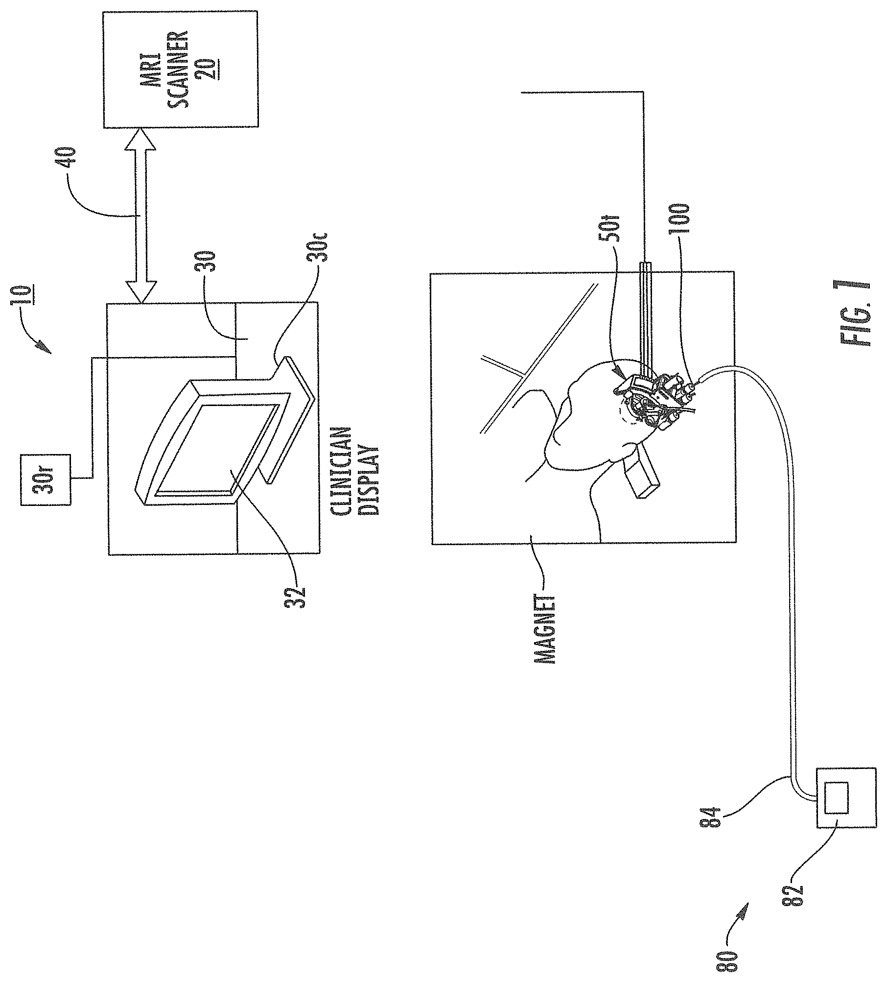 Patent US11793933 Figure 1 – MRI-compatible surgical cannulae for transferring a substance to and/or from a patient