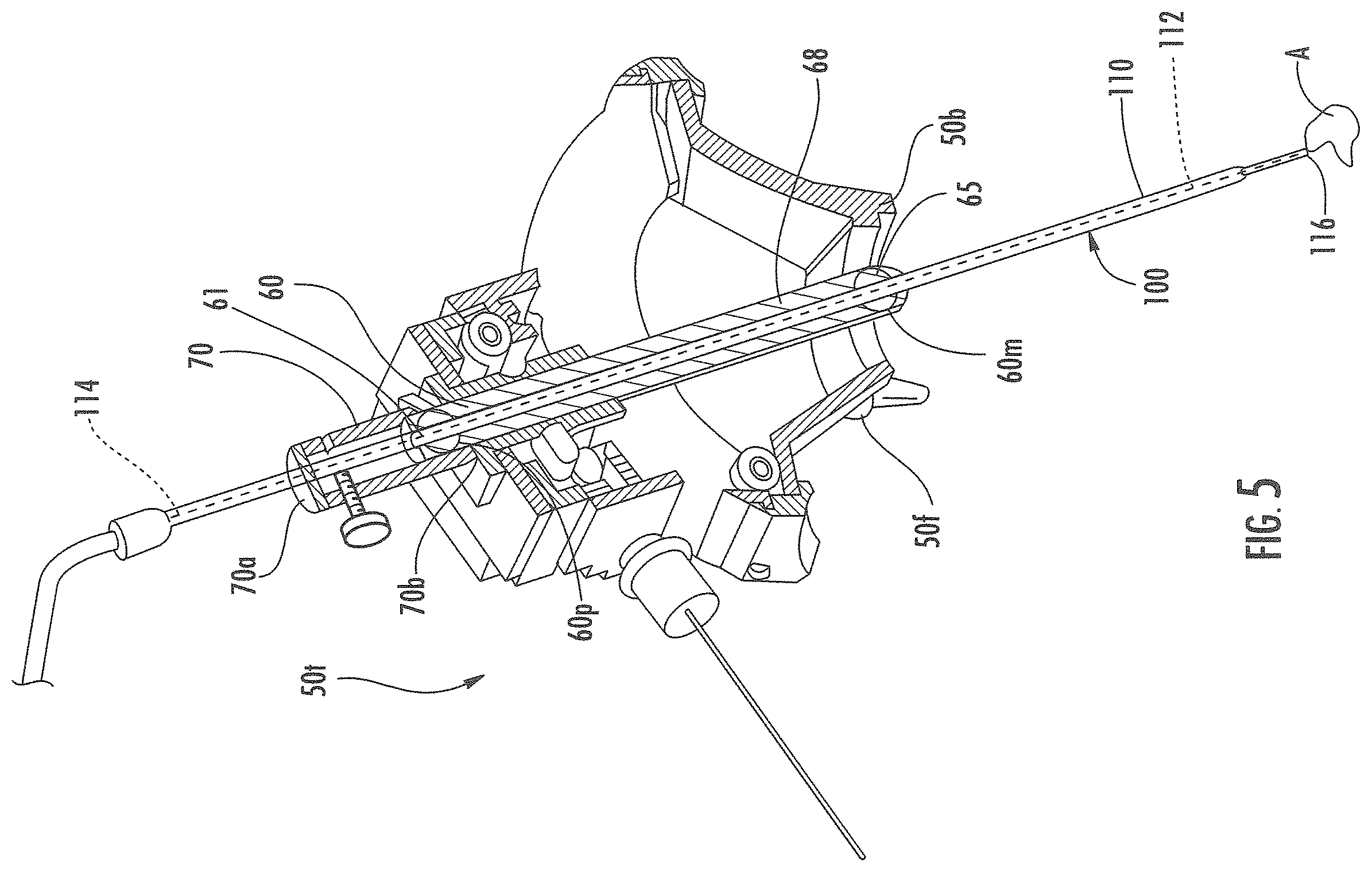 Patent US11793933 Figure 5 – MRI-compatible surgical cannulae for transferring a substance to and/or from a patient