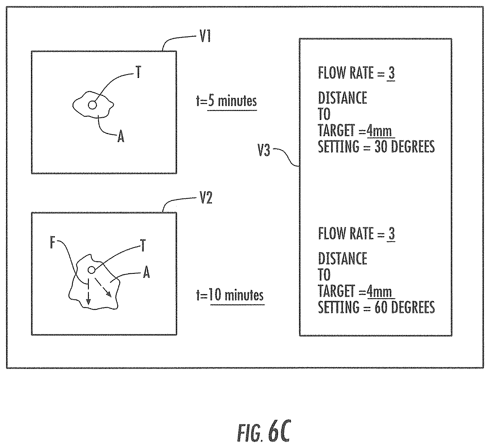 Patent US11793933 Figure 8 – MRI-compatible surgical cannulae for transferring a substance to and/or from a patient
