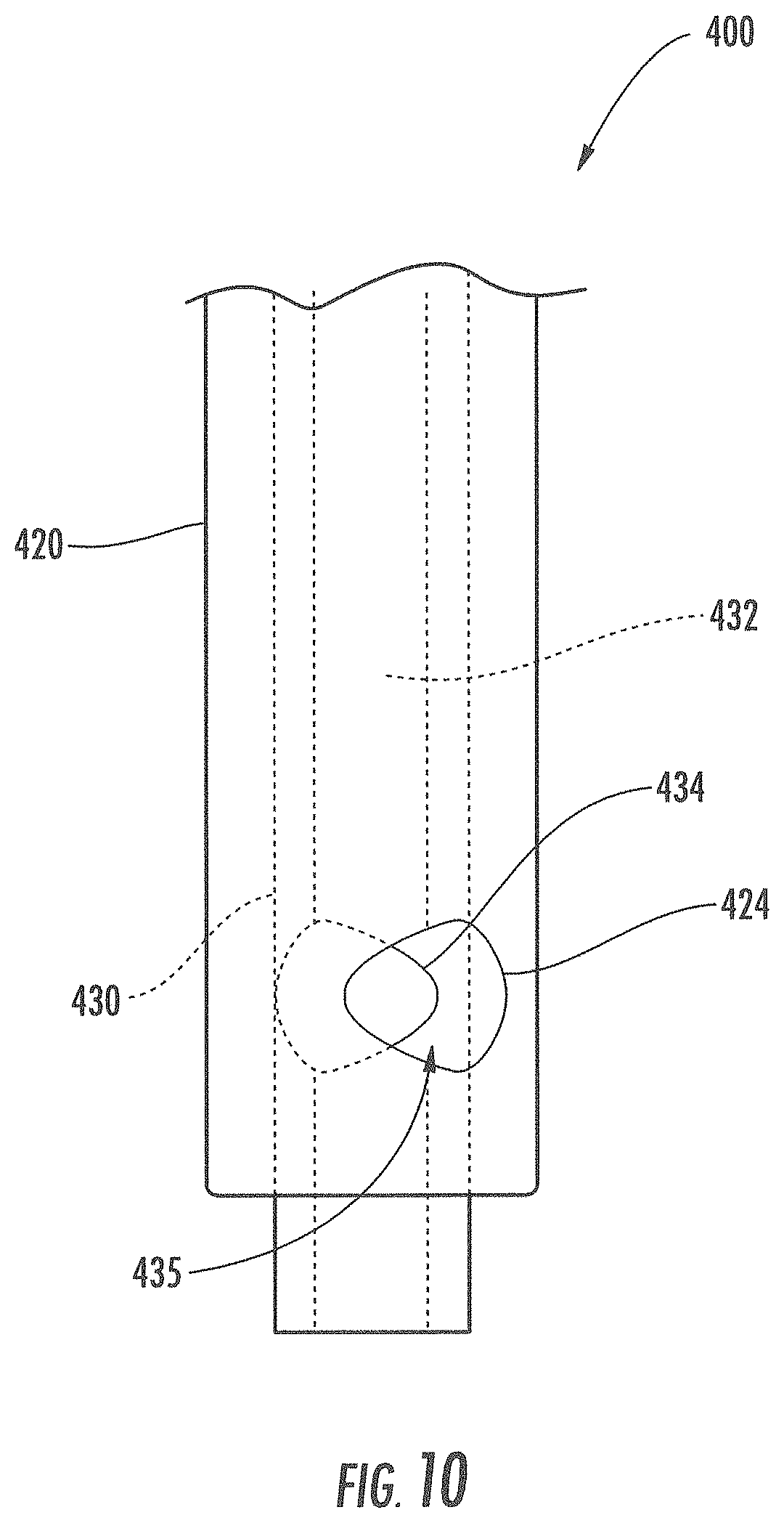 Patent US11793933 Figure 13 – MRI-compatible surgical cannulae for transferring a substance to and/or from a patient