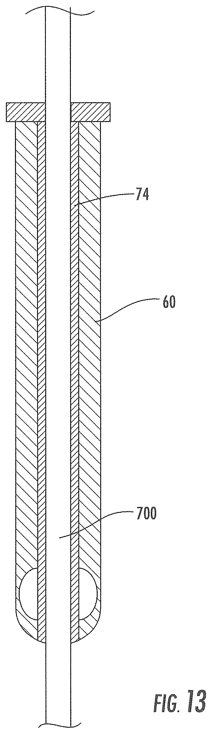 Patent US11793933 Figure 16 – MRI-compatible surgical cannulae for transferring a substance to and/or from a patient