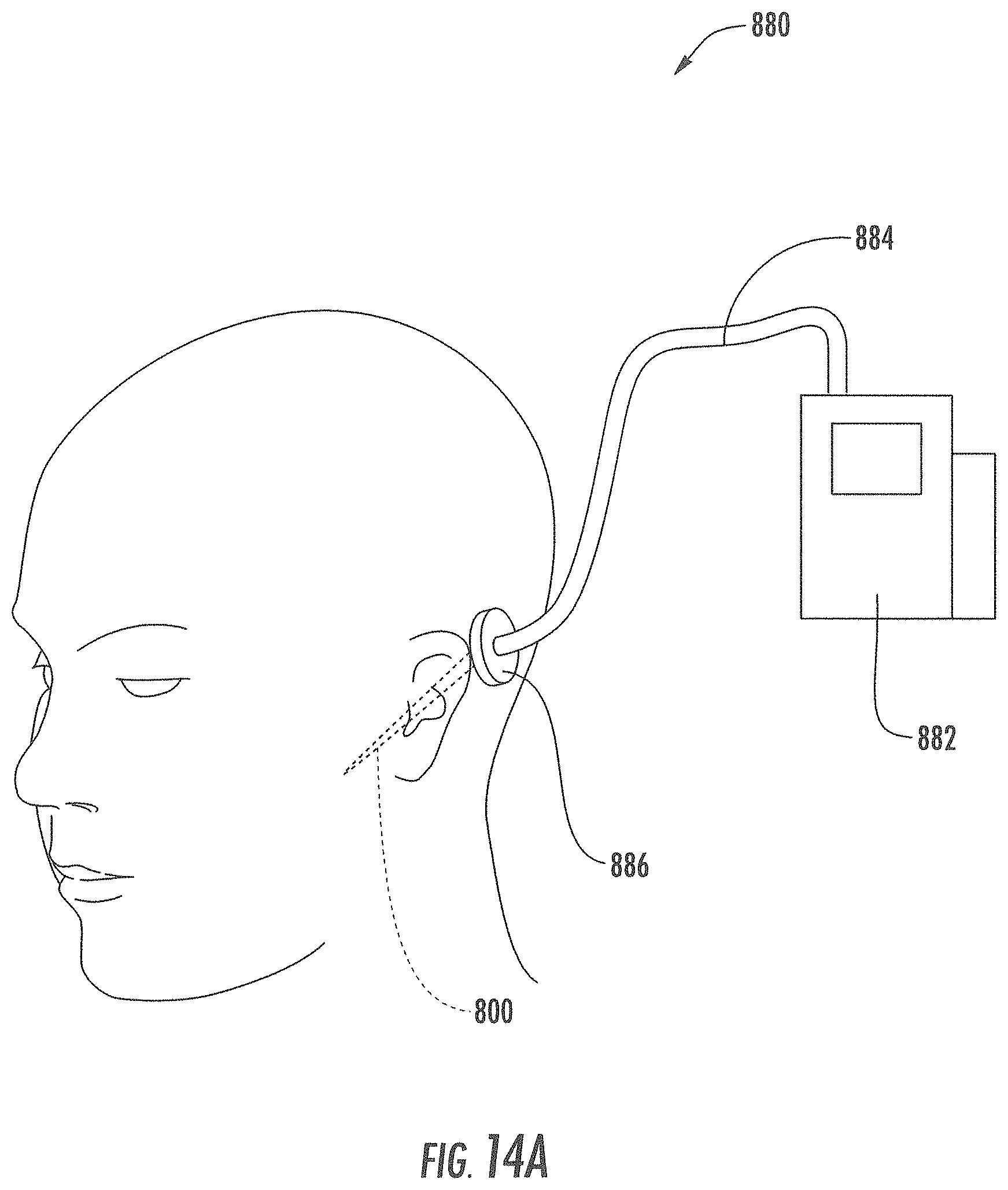 Patent US11793933 Figure 17 – MRI-compatible surgical cannulae for transferring a substance to and/or from a patient