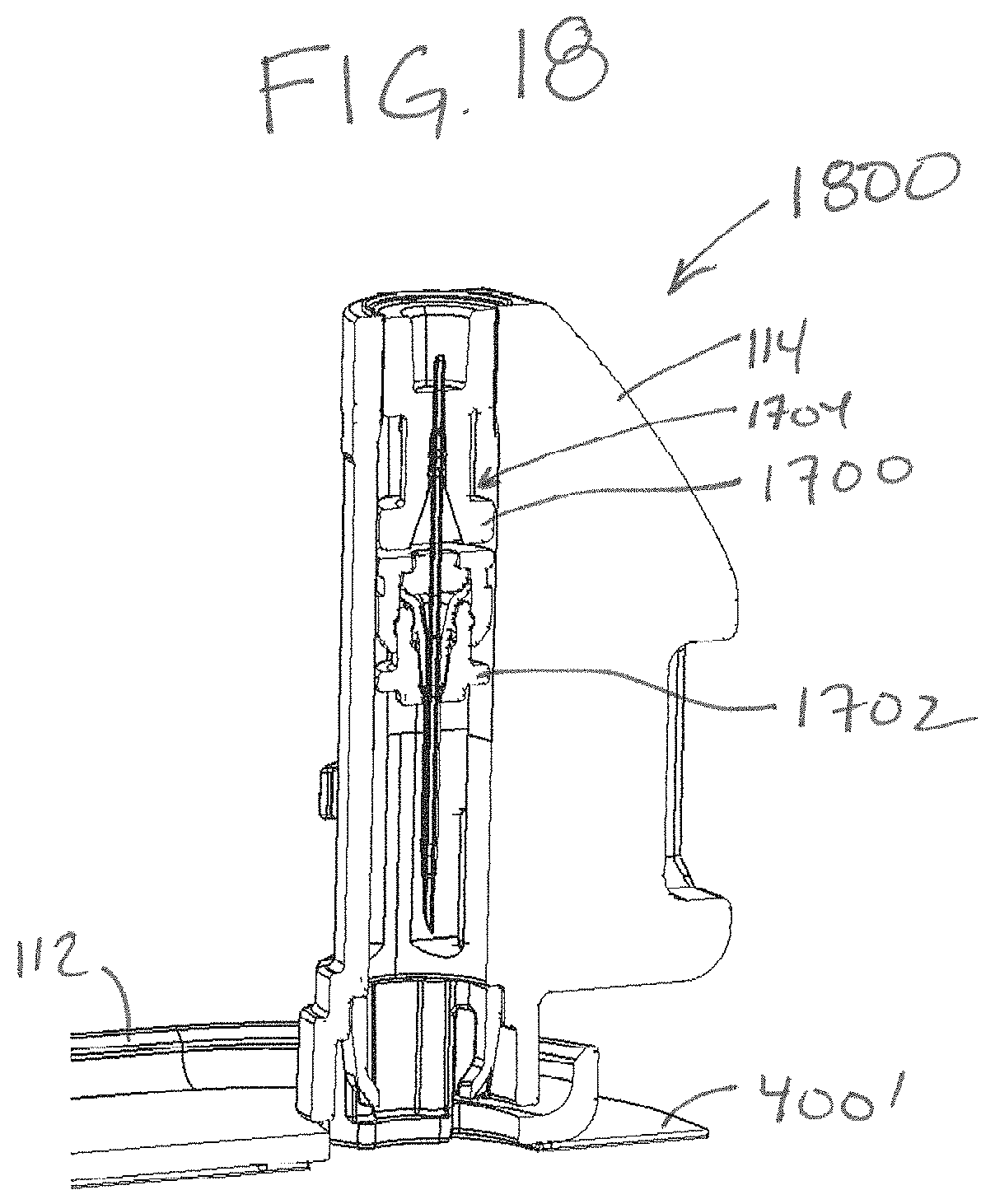 Patent US11793934 Figure 17 – Cartridge and inserter for a medical system