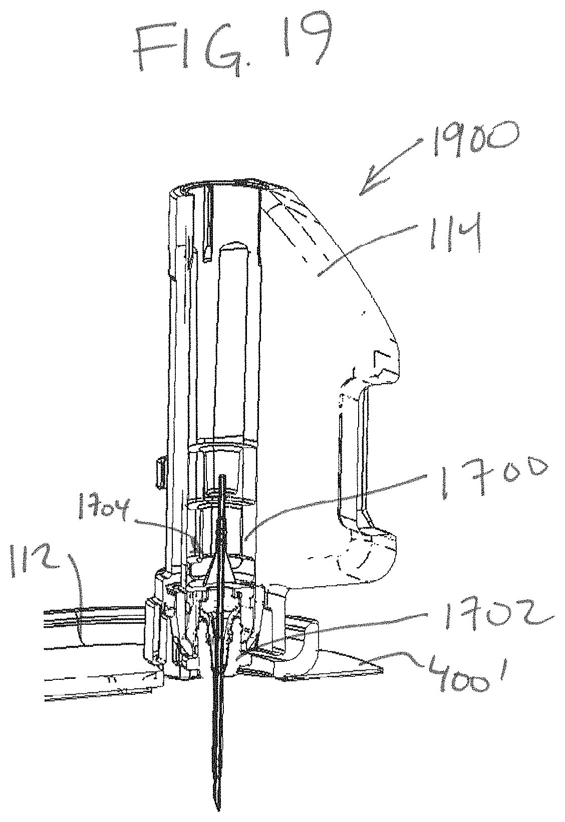 Patent US11793934 Figure 18 – Cartridge and inserter for a medical system