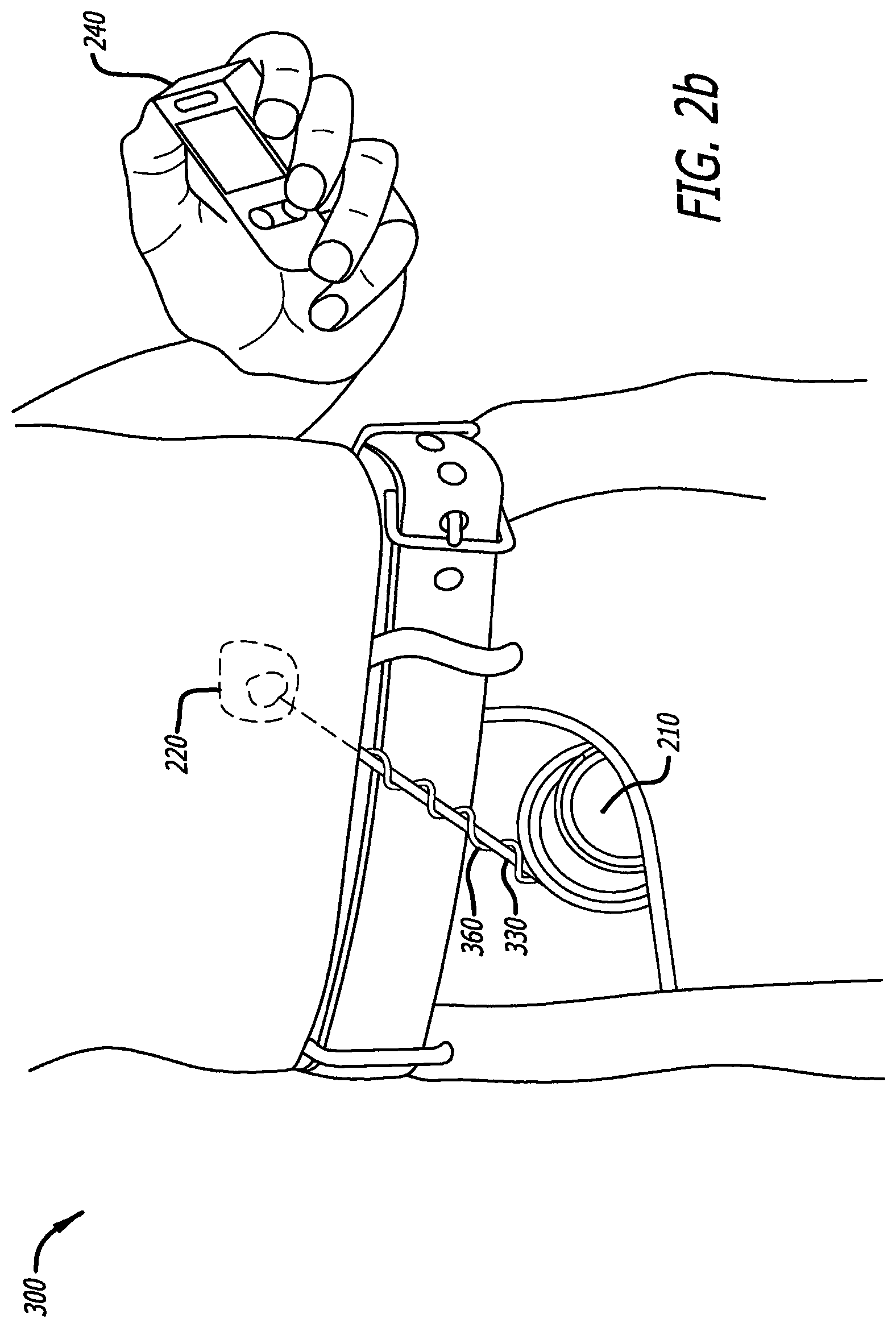 Patent US11793936 Figure 3 – Medical device antenna systems having external antenna configurations