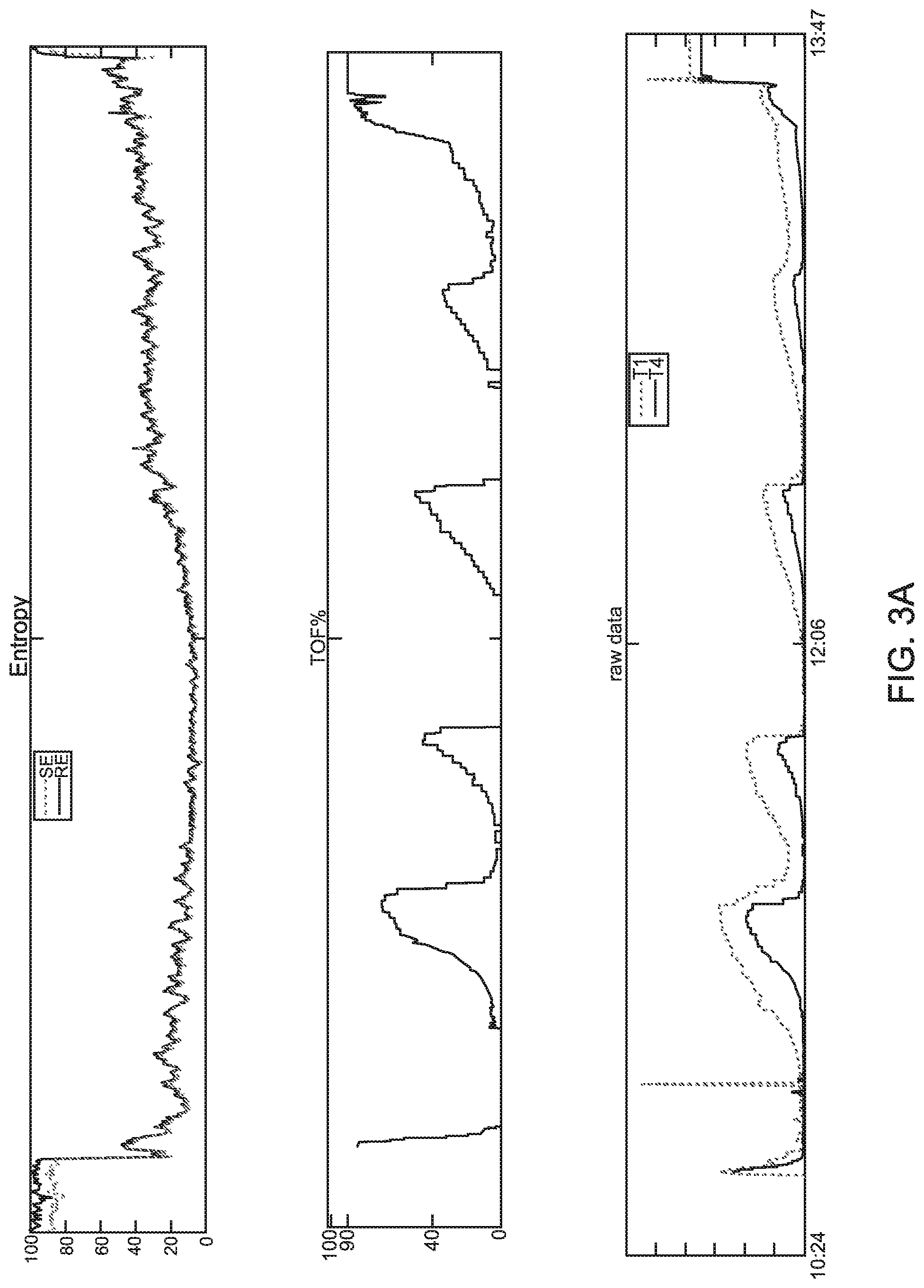 Patent US11793937 Figure 4 – Method and system for monitoring muscle relaxation of a patient and corresponding patient care system