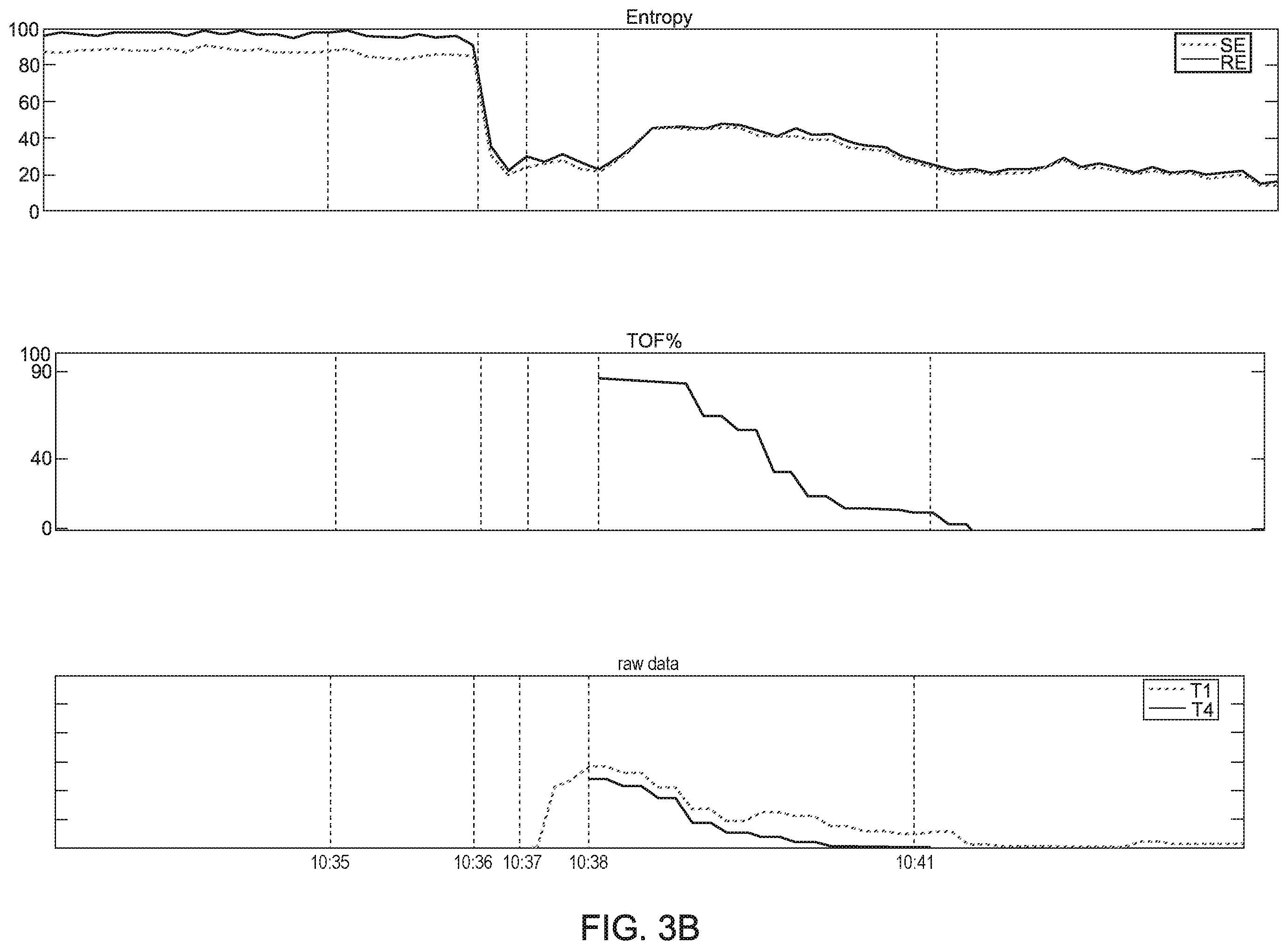 Patent US11793937 Figure 5 – Method and system for monitoring muscle relaxation of a patient and corresponding patient care system