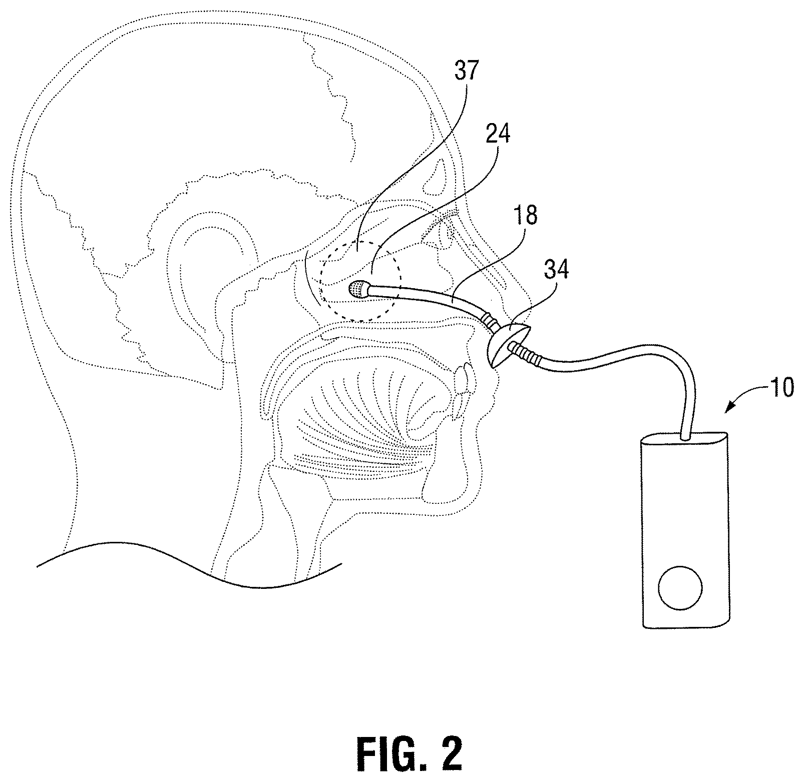 Patent US11793946 Figure 2 – Delivery device and method for intranasal administration of topical therapeutic agents
