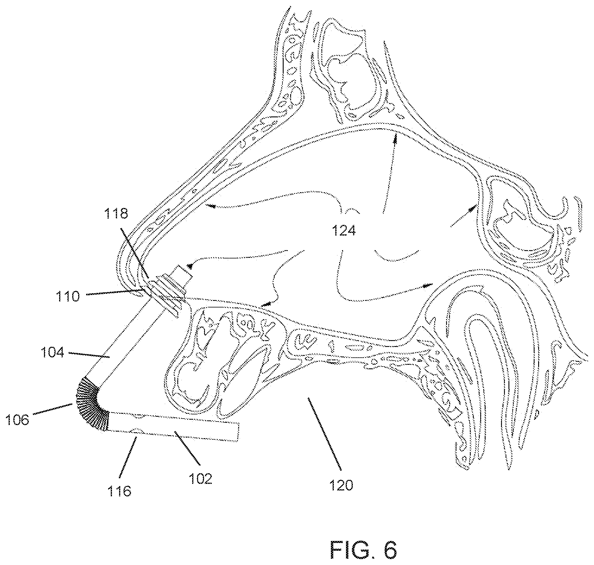 Patent US11793950 Figure 4 – Medicament delivery device and method