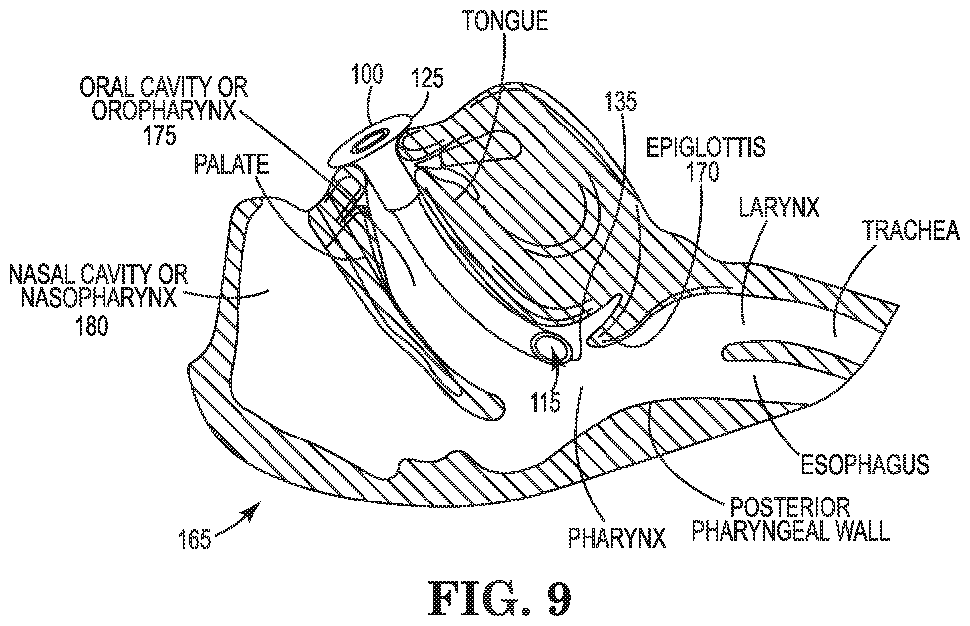 Patent US11793960 Figure 10 – Oral medical apparatus
