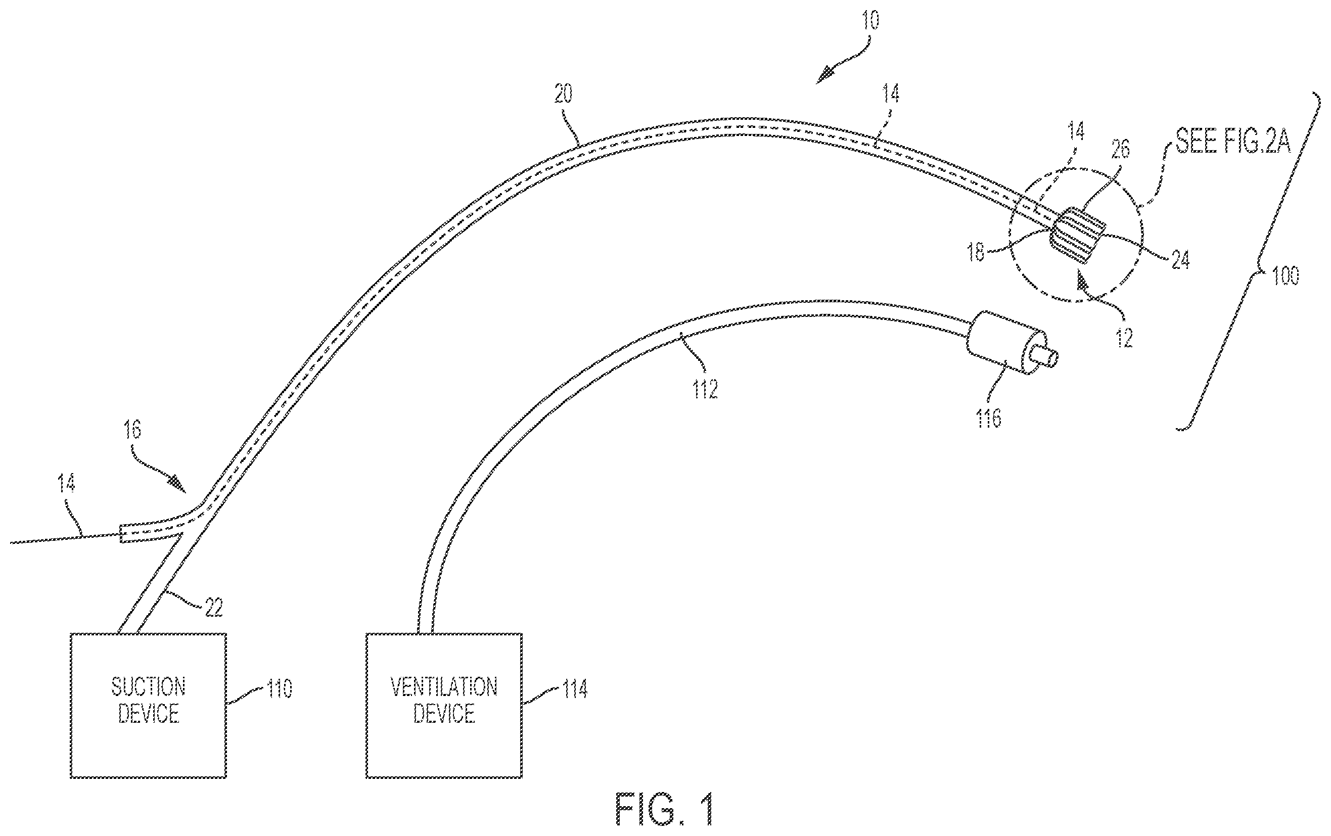 Patent US11793961 Figure 1 – Esophageal temporary occlusion device and method for endotracheal intubation and orogastric tube insertion