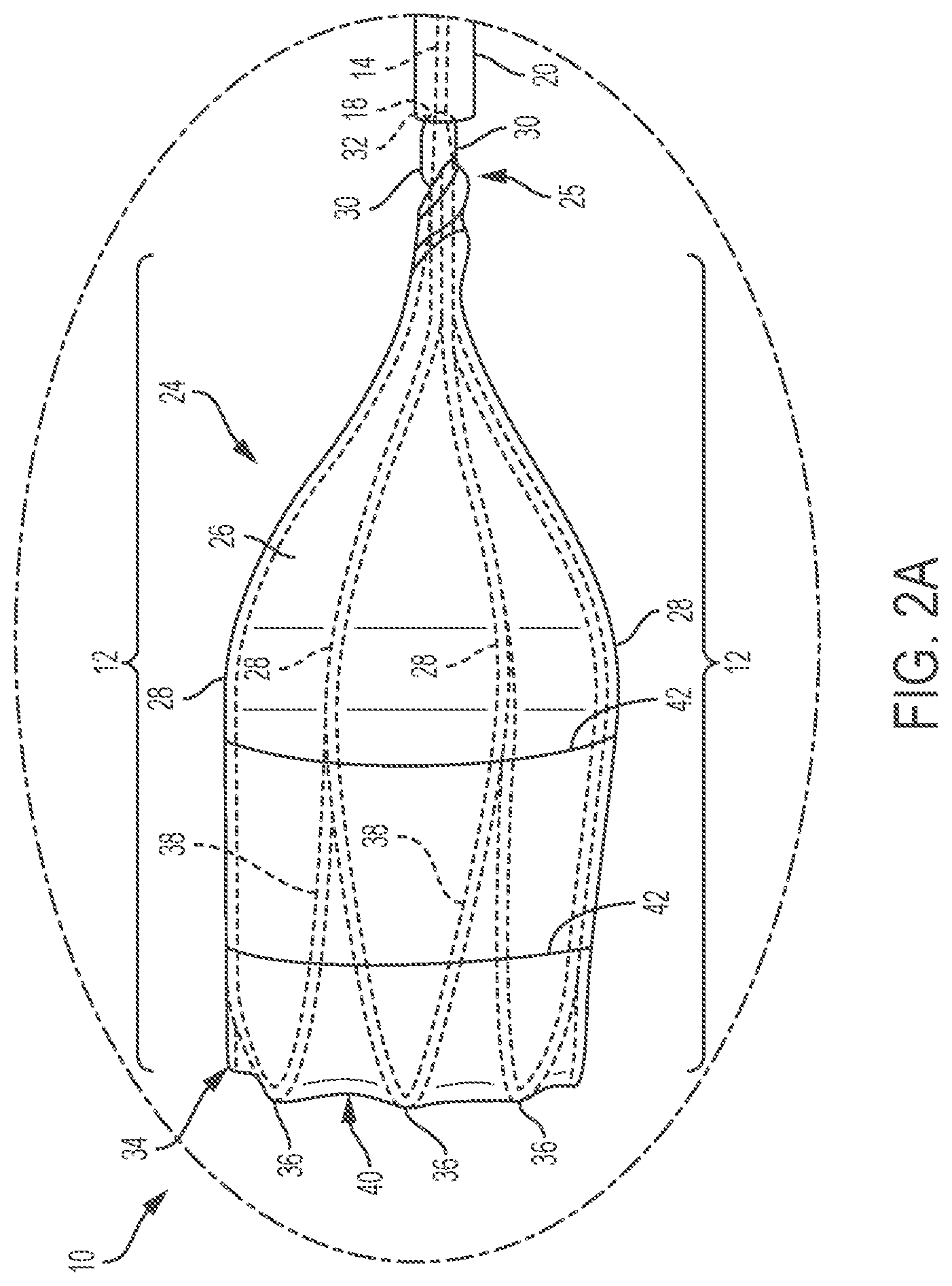 Patent US11793961 Figure 2 – Esophageal temporary occlusion device and method for endotracheal intubation and orogastric tube insertion