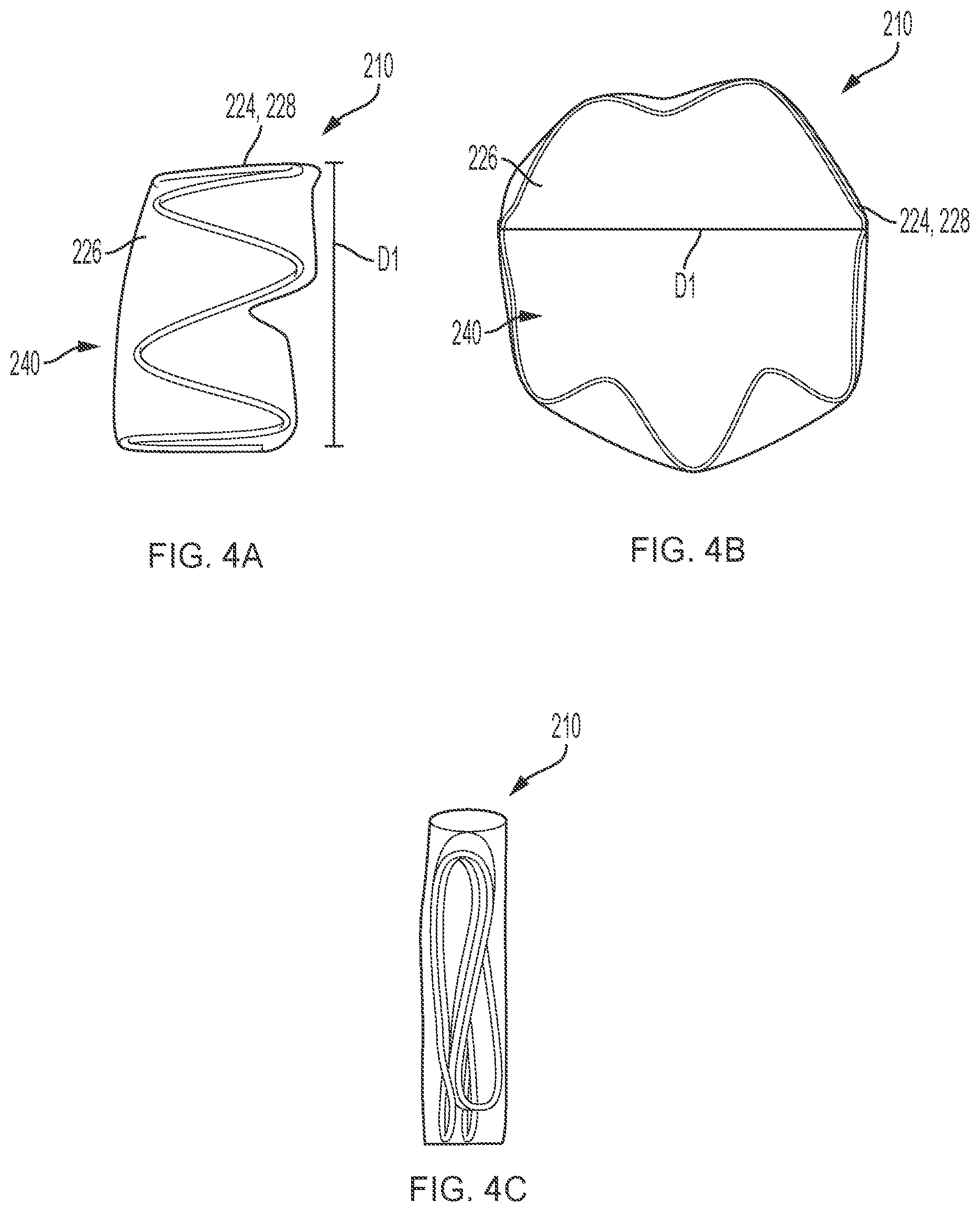 Patent US11793961 Figure 5 – Esophageal temporary occlusion device and method for endotracheal intubation and orogastric tube insertion