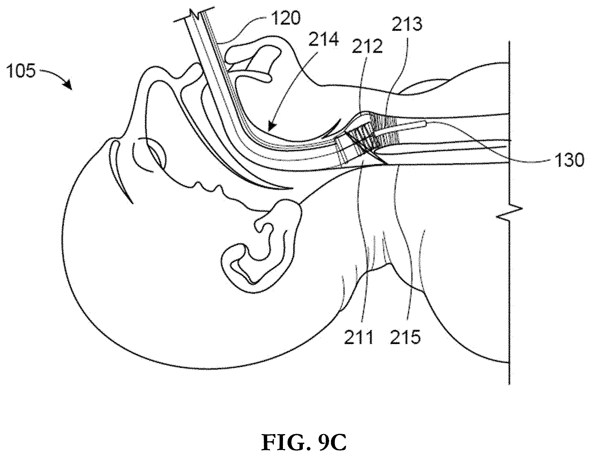 Patent US11793962 Figure 14 – Intubation system, method, and device