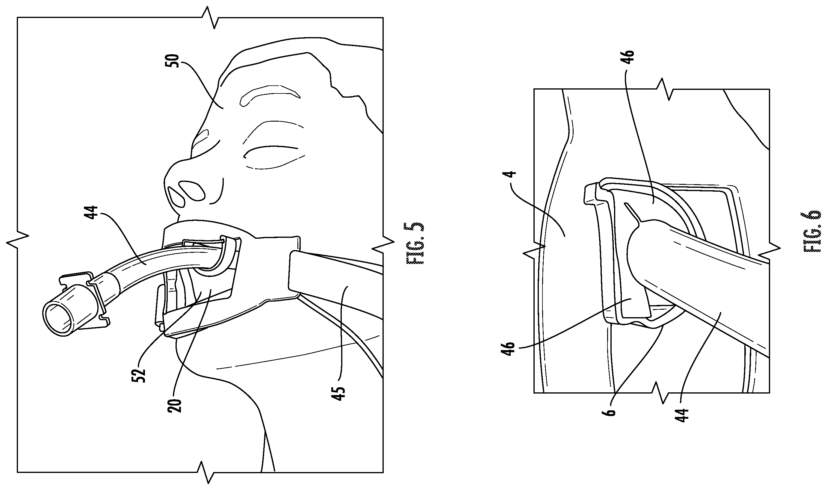 Patent US11793963 Figure 3 – Ambulatory tube support for endotracheal tubing
