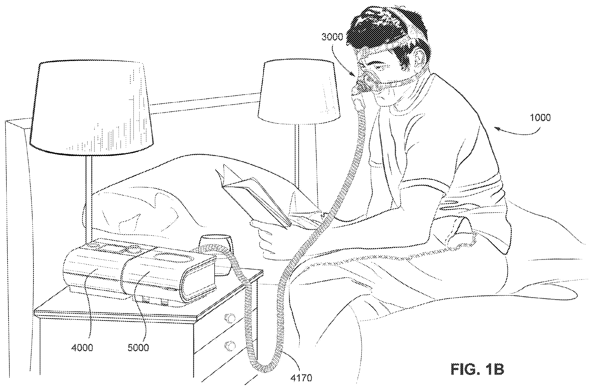 Patent US11793965 Figure 2 – Adjustable headgear tubing for a patient interface