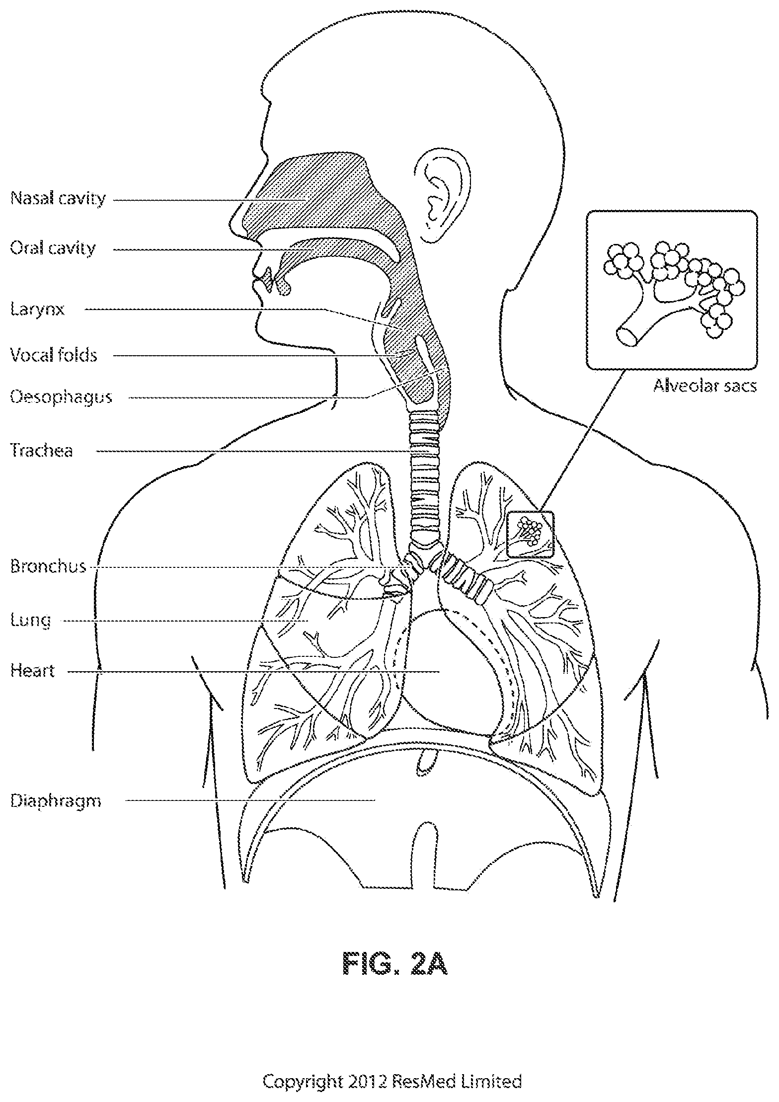 Patent US11793965 Figure 4 – Adjustable headgear tubing for a patient interface