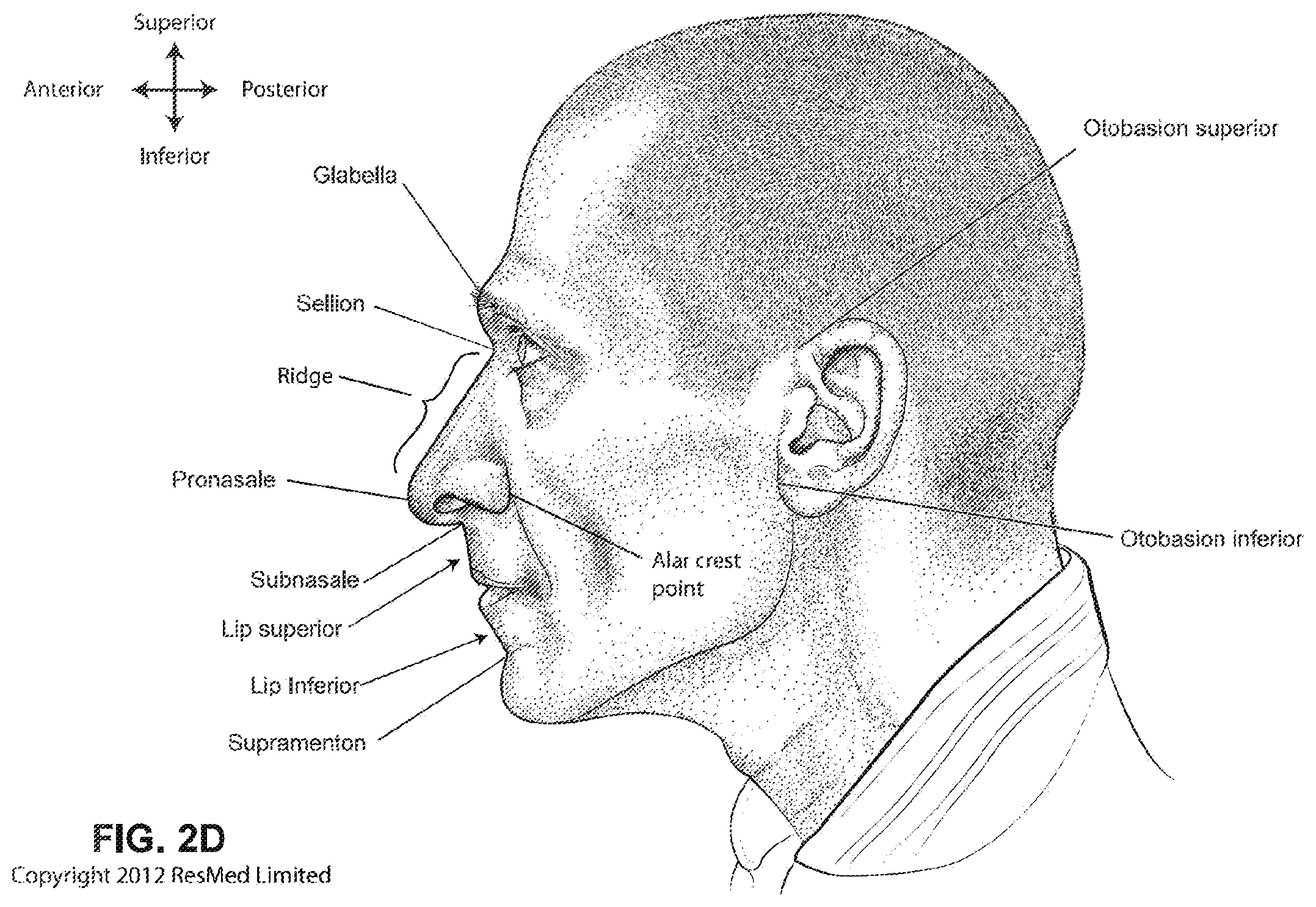 Patent US11793965 Figure 7 – Adjustable headgear tubing for a patient interface