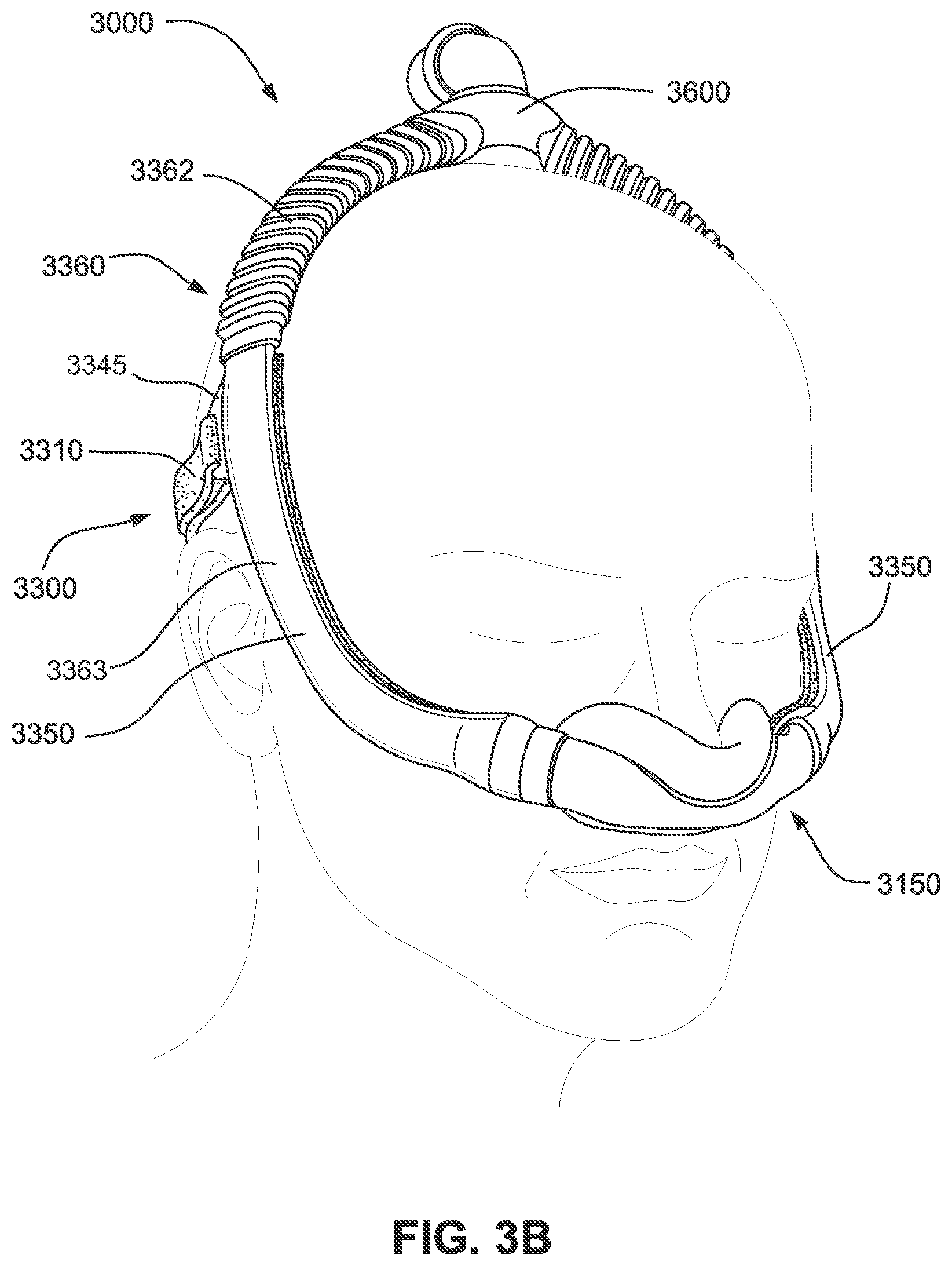 Patent US11793965 Figure 11 – Adjustable headgear tubing for a patient interface