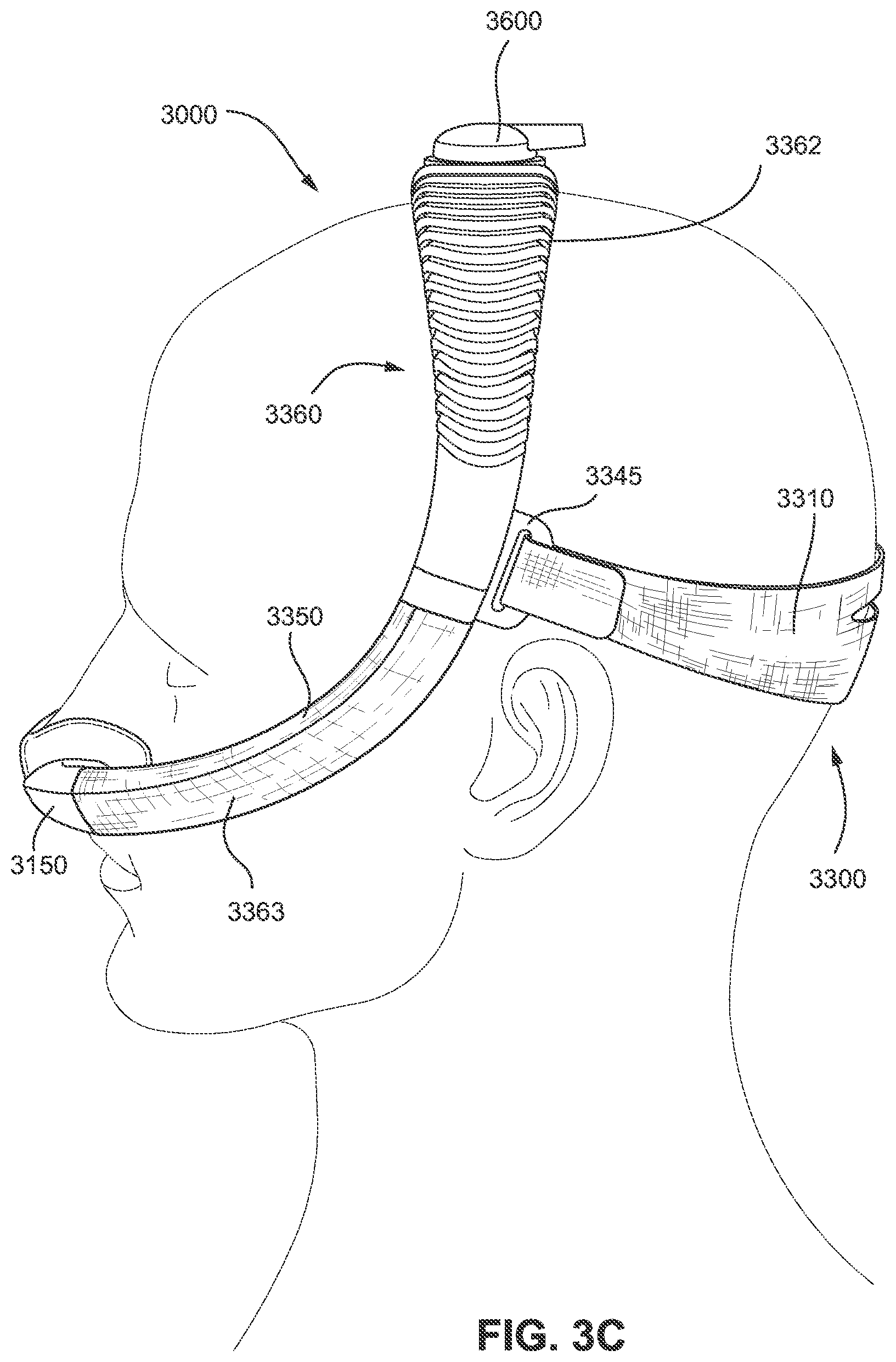 Patent US11793965 Figure 12 – Adjustable headgear tubing for a patient interface