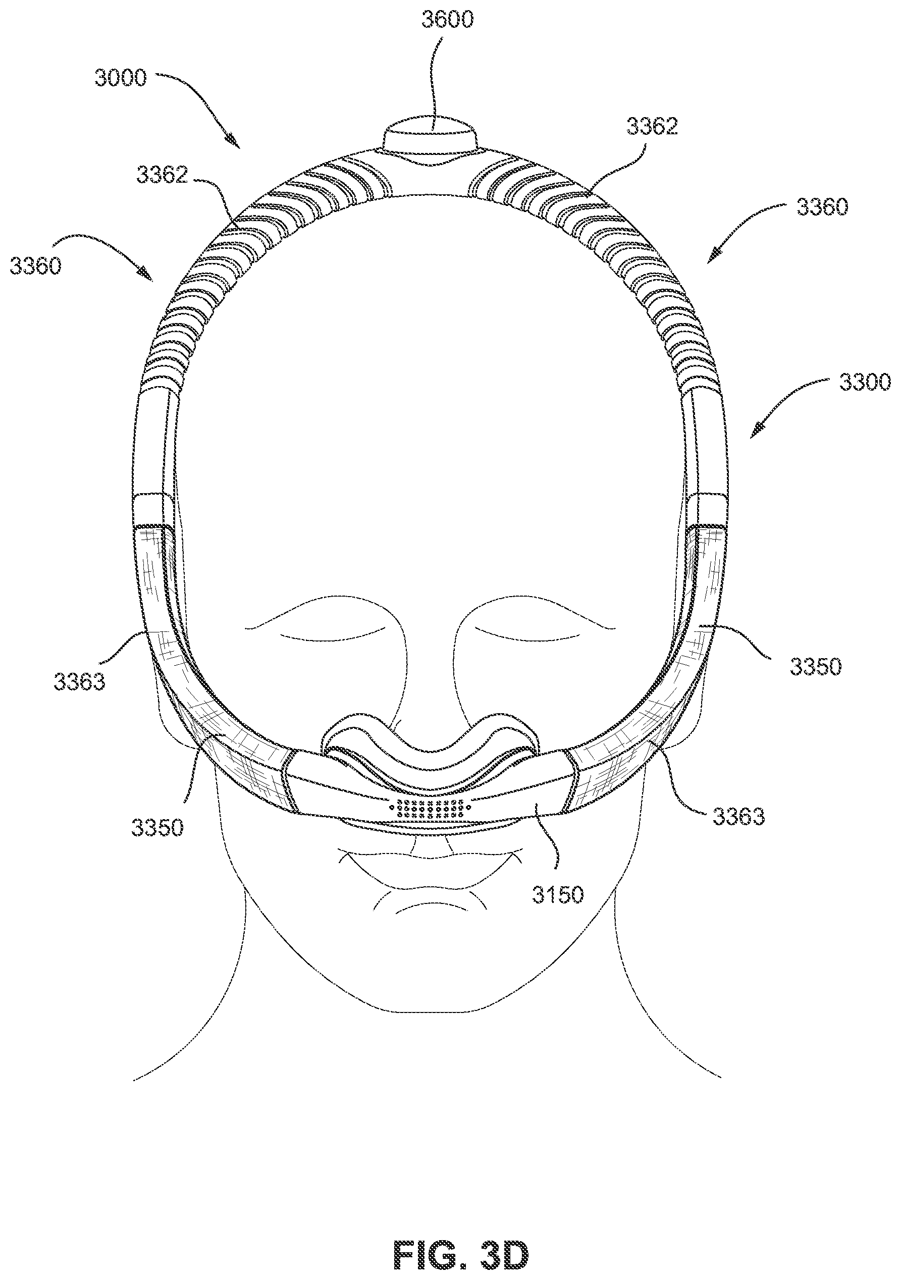 Patent US11793965 Figure 13 – Adjustable headgear tubing for a patient interface