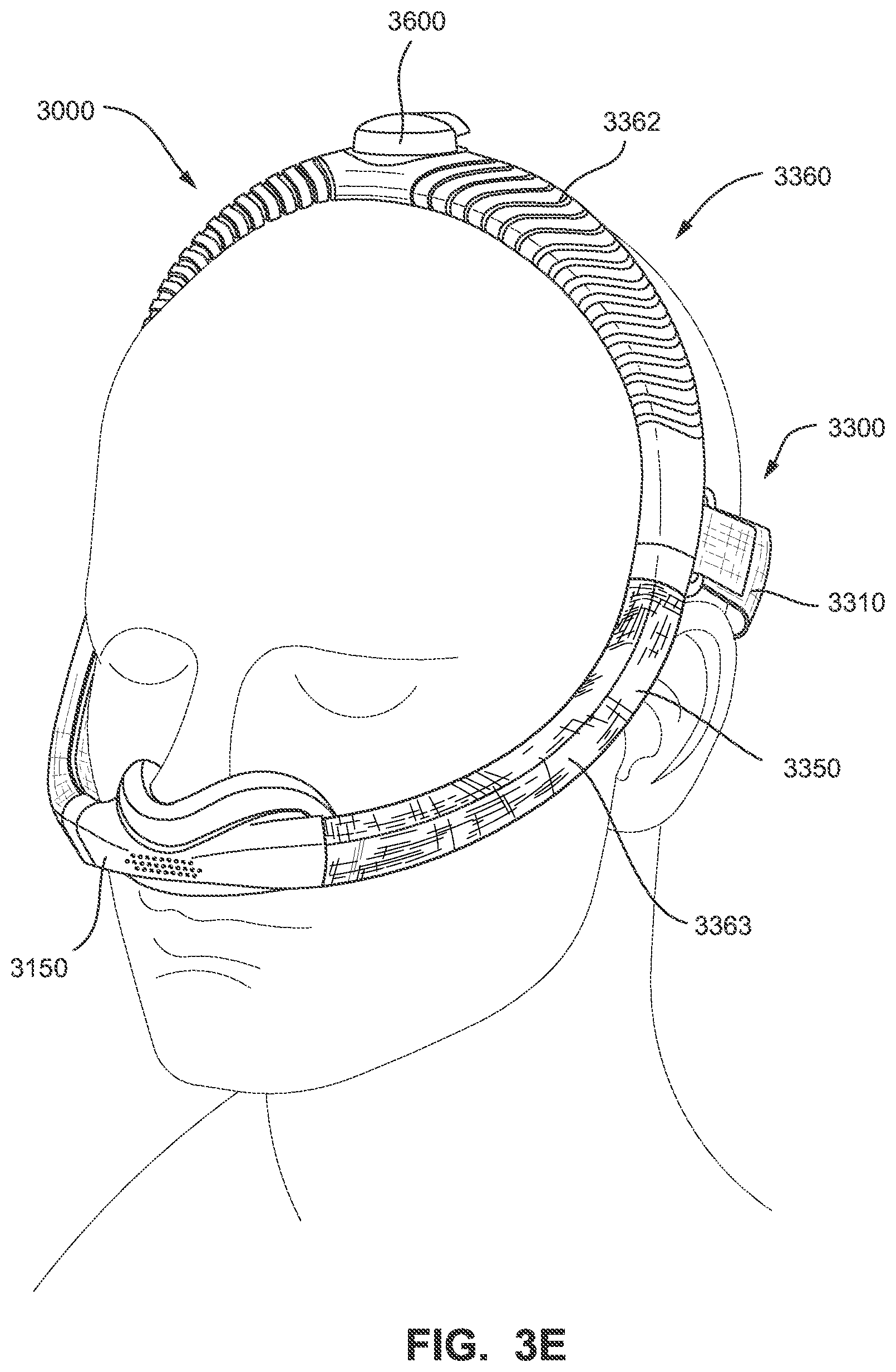 Patent US11793965 Figure 14 – Adjustable headgear tubing for a patient interface