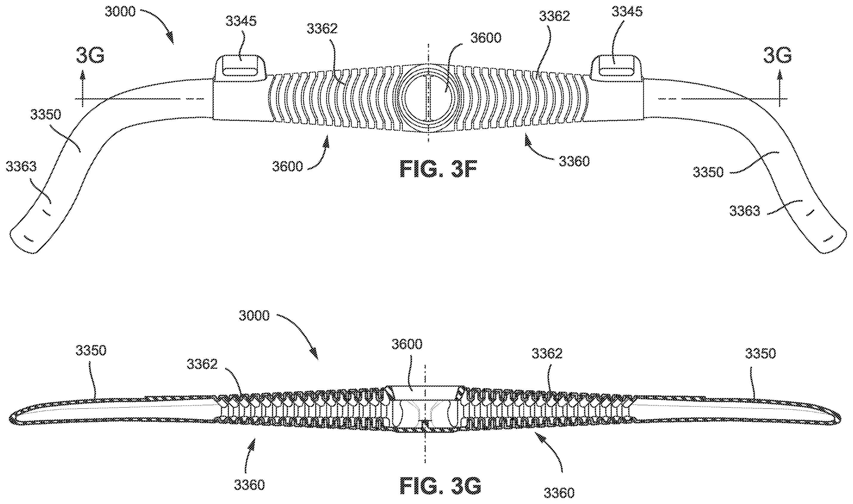 Patent US11793965 Figure 15 – Adjustable headgear tubing for a patient interface