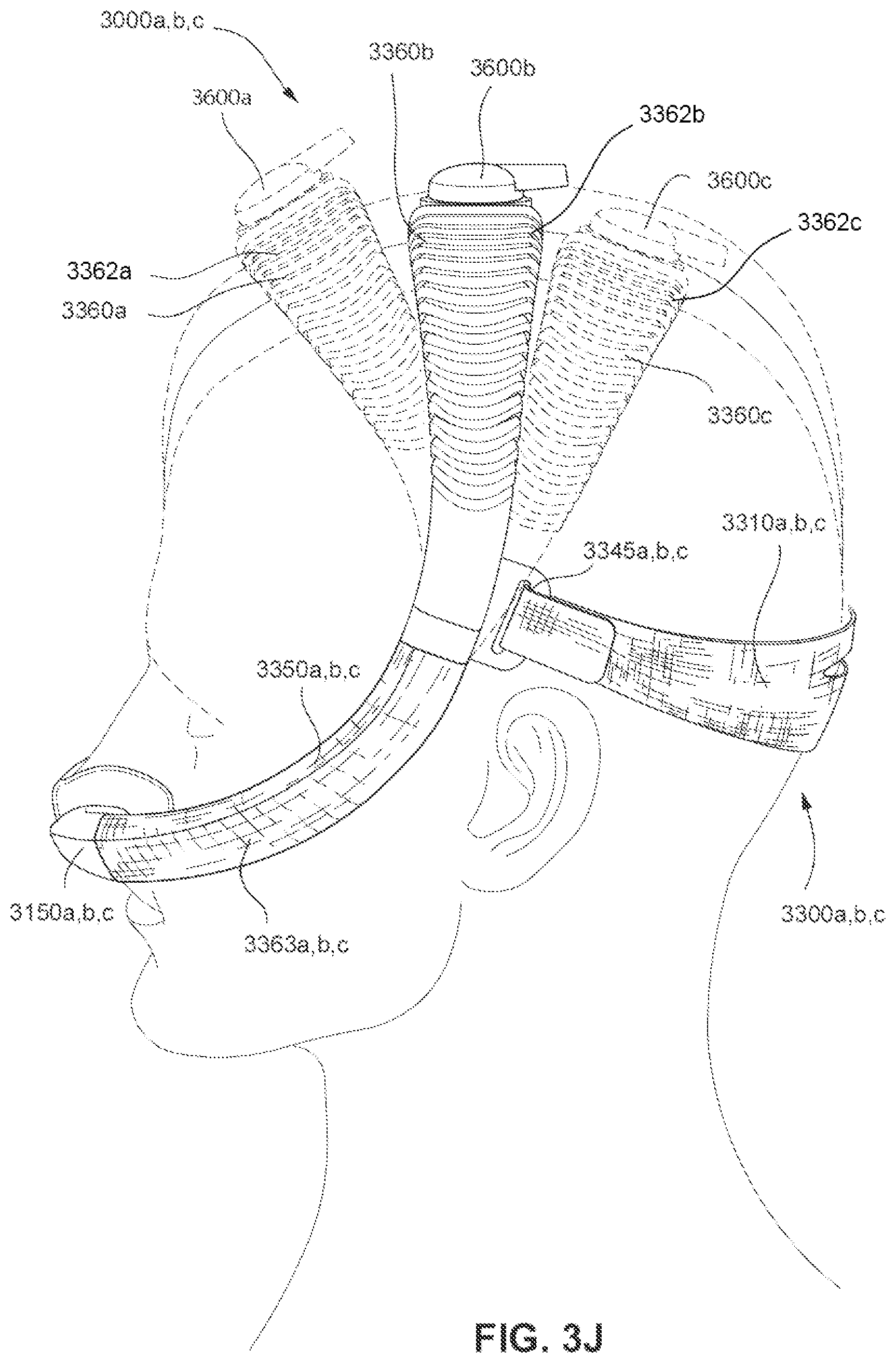 Patent US11793965 Figure 18 – Adjustable headgear tubing for a patient interface