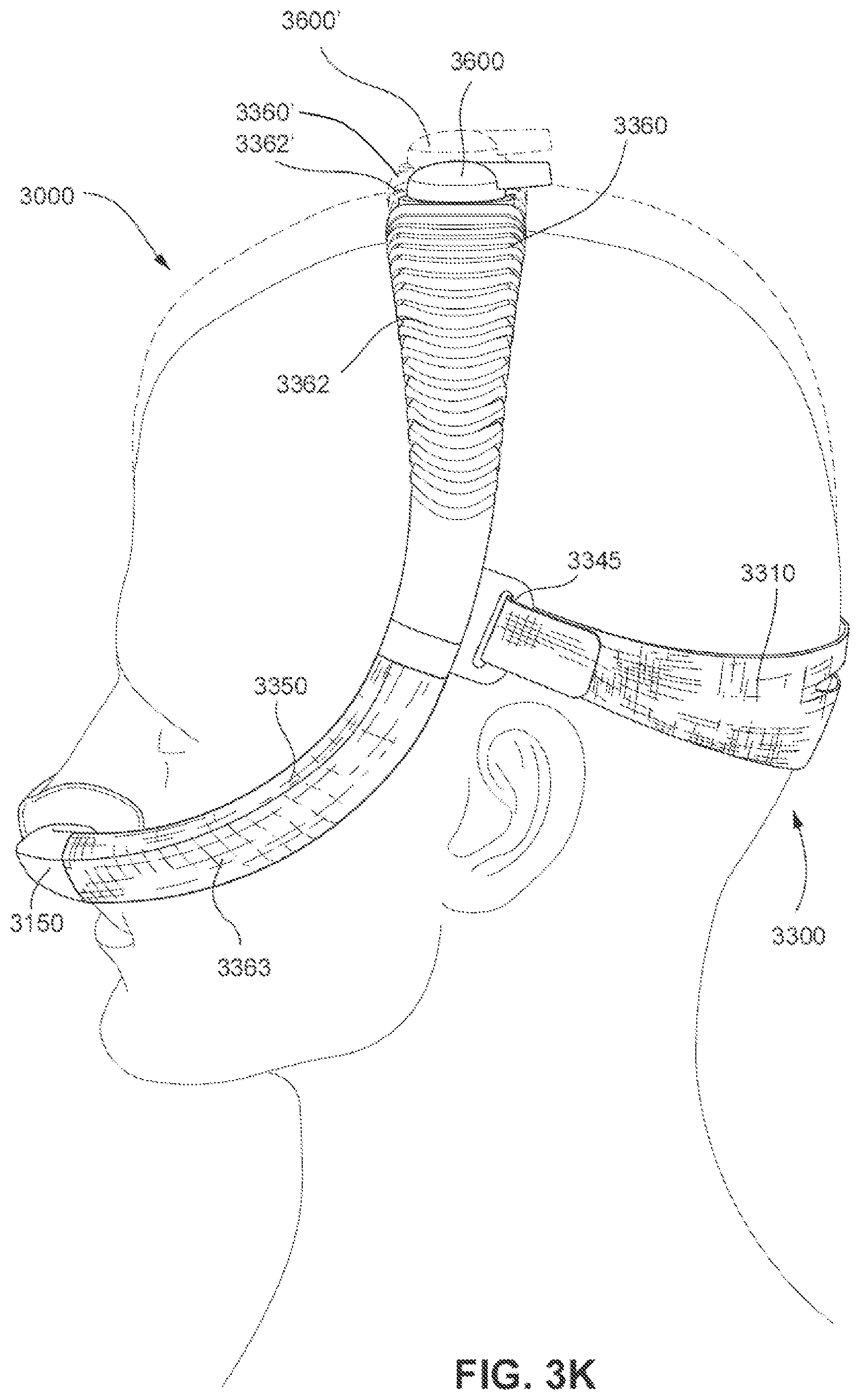 Patent US11793965 Figure 19 – Adjustable headgear tubing for a patient interface