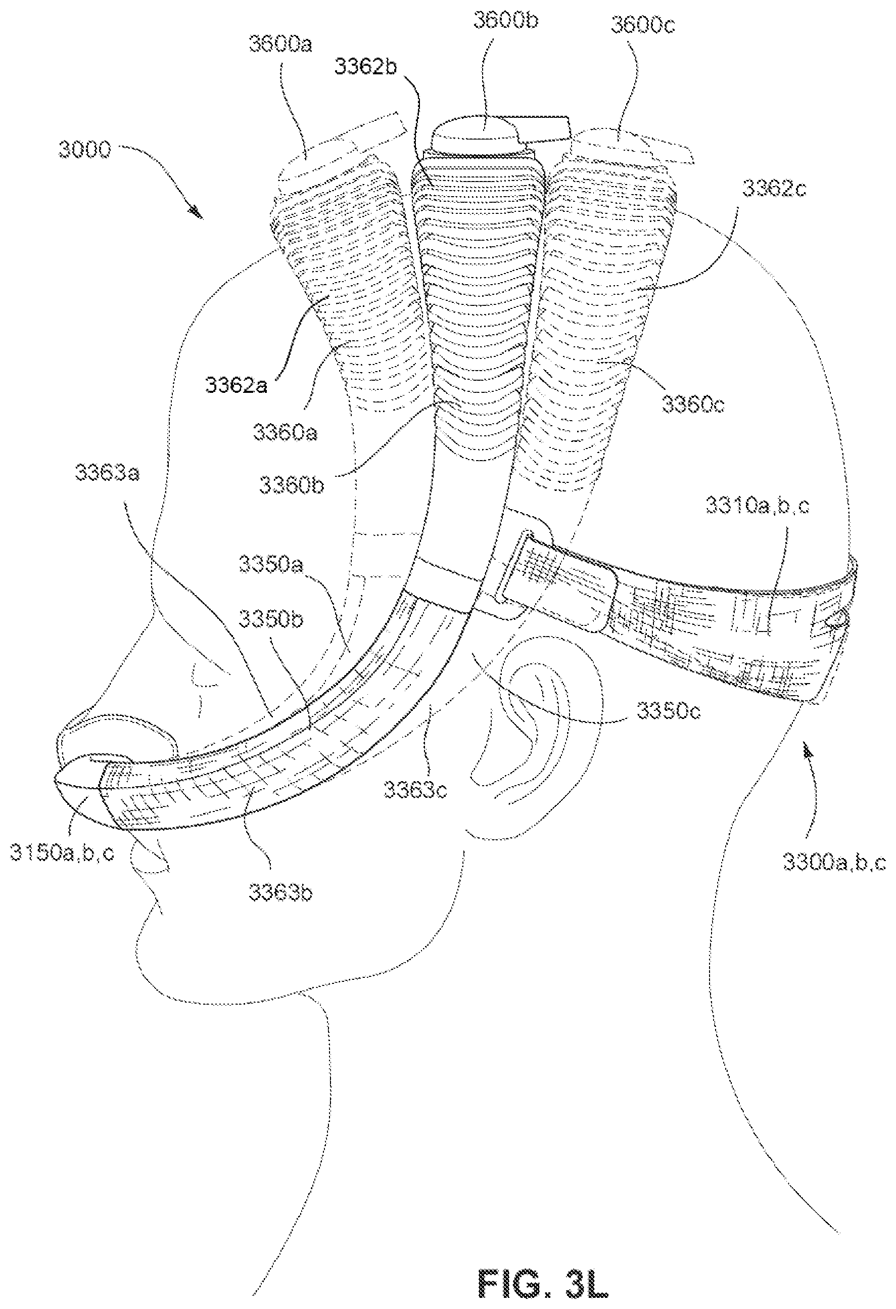 Patent US11793965 Figure 20 – Adjustable headgear tubing for a patient interface